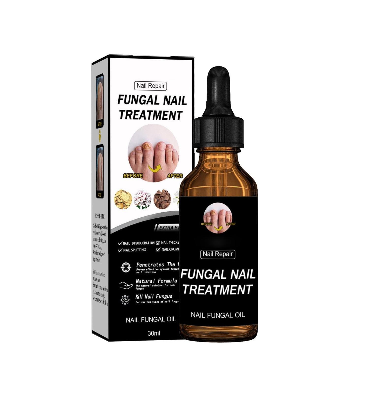 Nail Liquid Thickening Shiny Nails Grey Nails Dead Skin Moisturising Nail Nutrition Care Liquid 30ml 50ml CnJ78 (A One Size) 1 count (Pack of 1) a - Buy Online on GoSupps.com