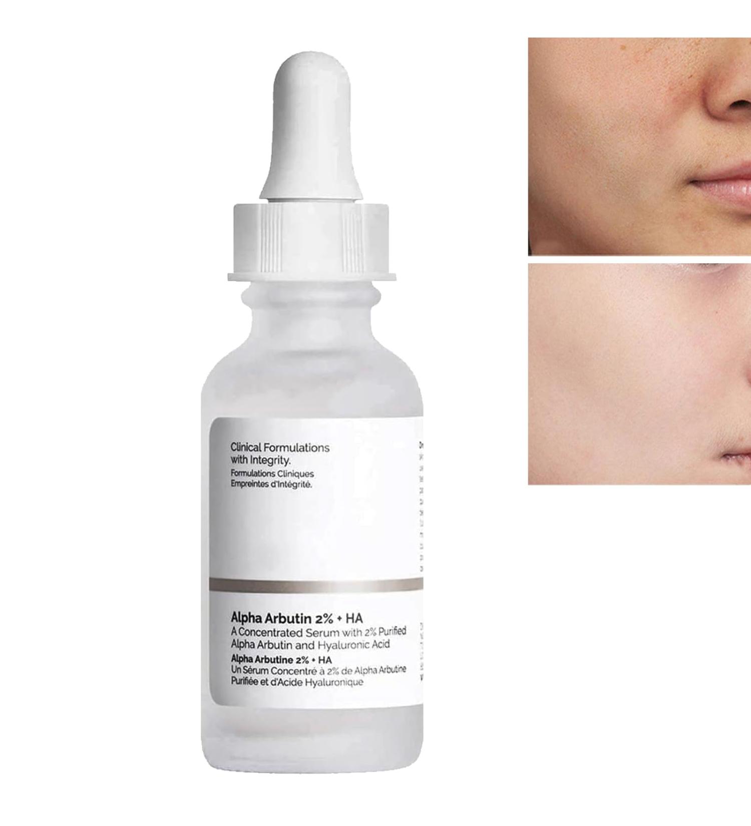 Hyaluronic Acid B5 Face Serum Hyaluronic Acid B5 Essence Hyaluronic Acid Serum for Hydrated Hyalu B5 Serum Vitamin B5 Skin Essence Hyalu B5 Essence Hyaluronic Acid Serum - Buy Online on GoSupps.com