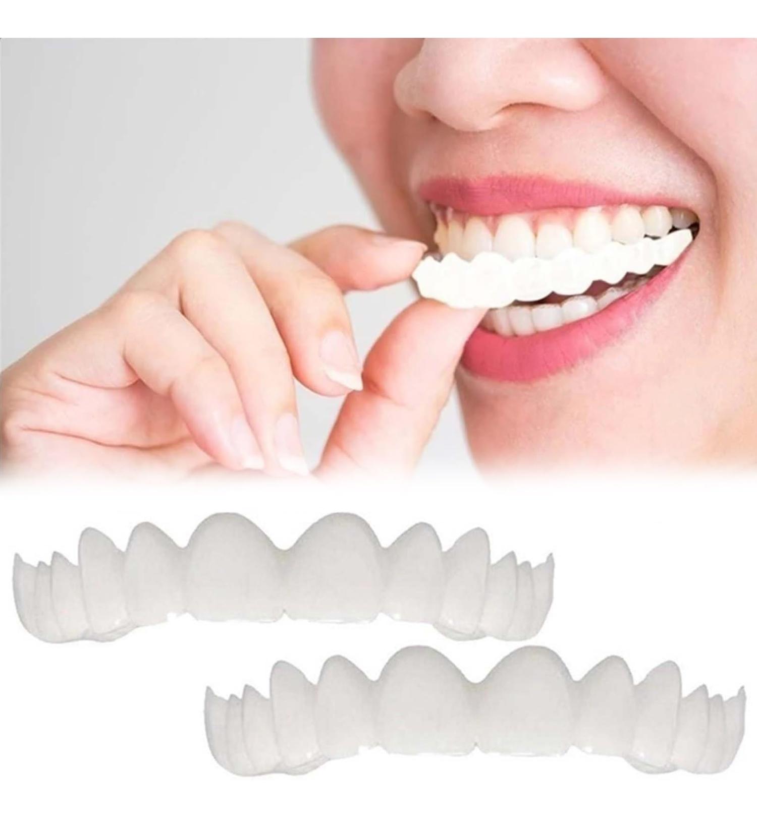 2 Pairs Regain Confidence Smile for Women and Men Temporarily Adjustable Regain Beautiful Smile (1) - Buy Online on GoSupps.com