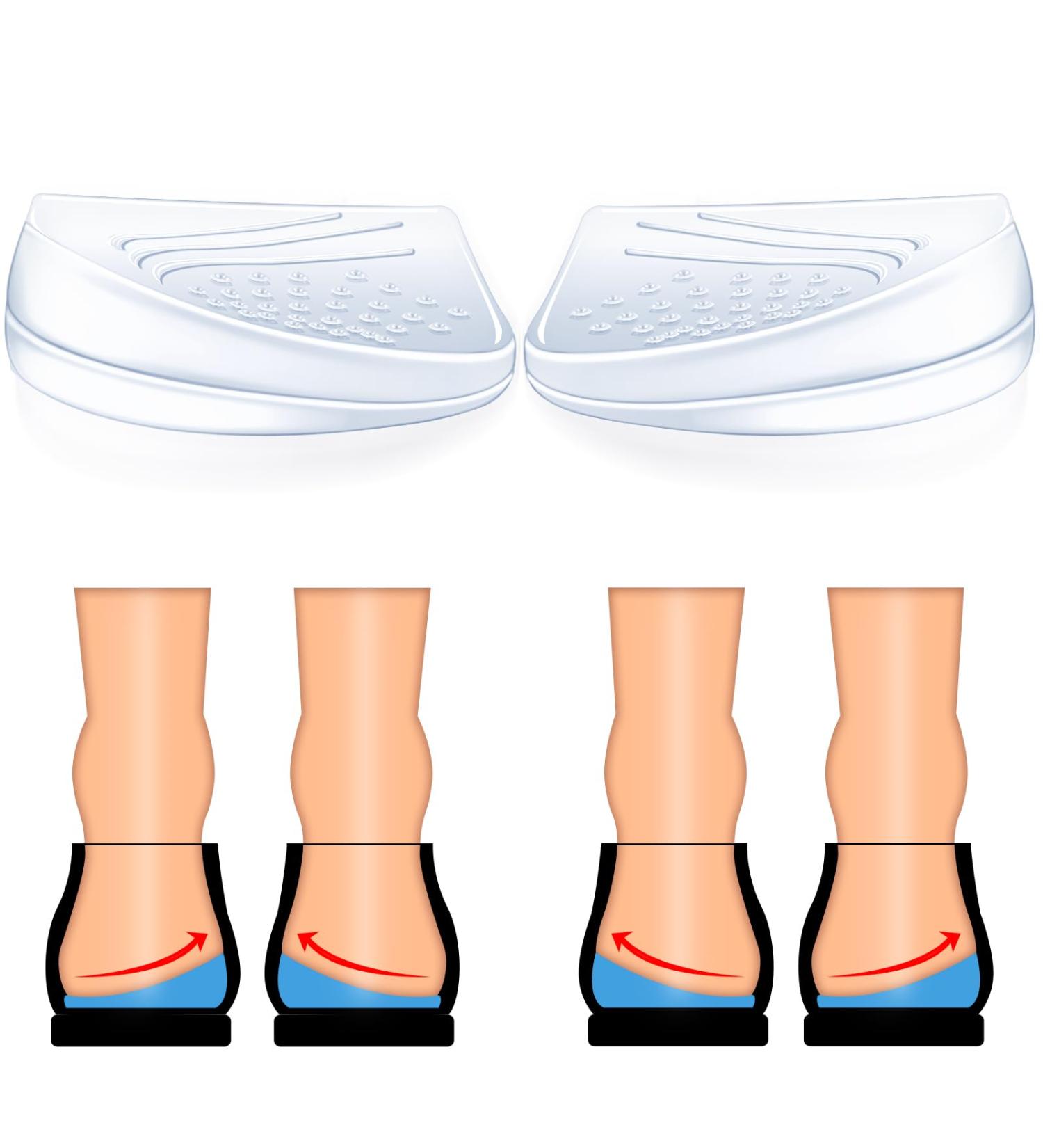 2 Layers Adjustable Heel Correction Insoles | Supination & Pronation Relief | Knee Pain & Foot Alignment | Orthopedic Solution for Leg Length Discrepancies - Large - Buy Online on GoSupps.com
