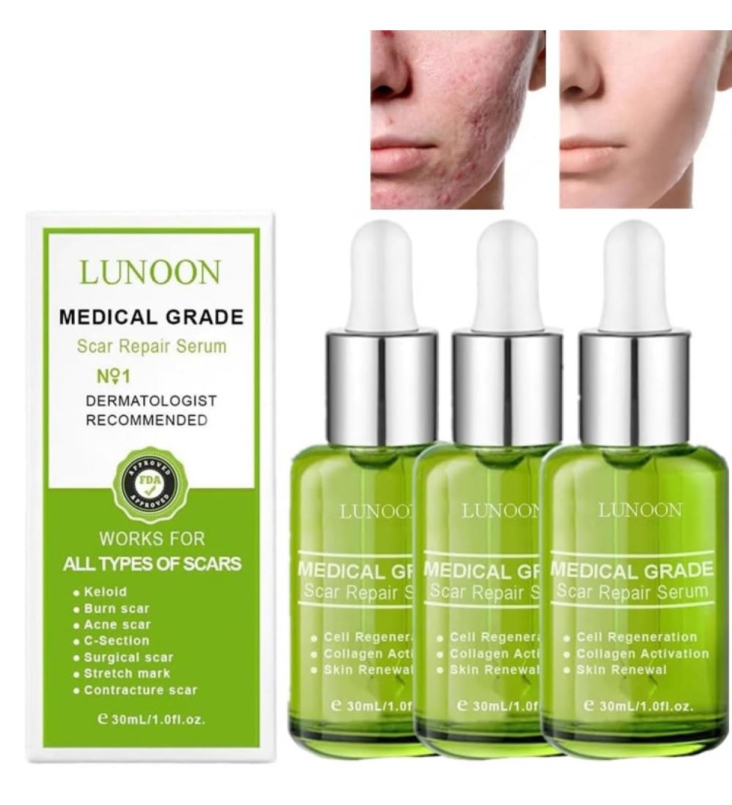 TURSHI Goopgen Advanced Scar Repair Serum - Medical Grade Nature Scar Treatment for All Types of Scars (3pcs) - Buy Online on GoSupps.com