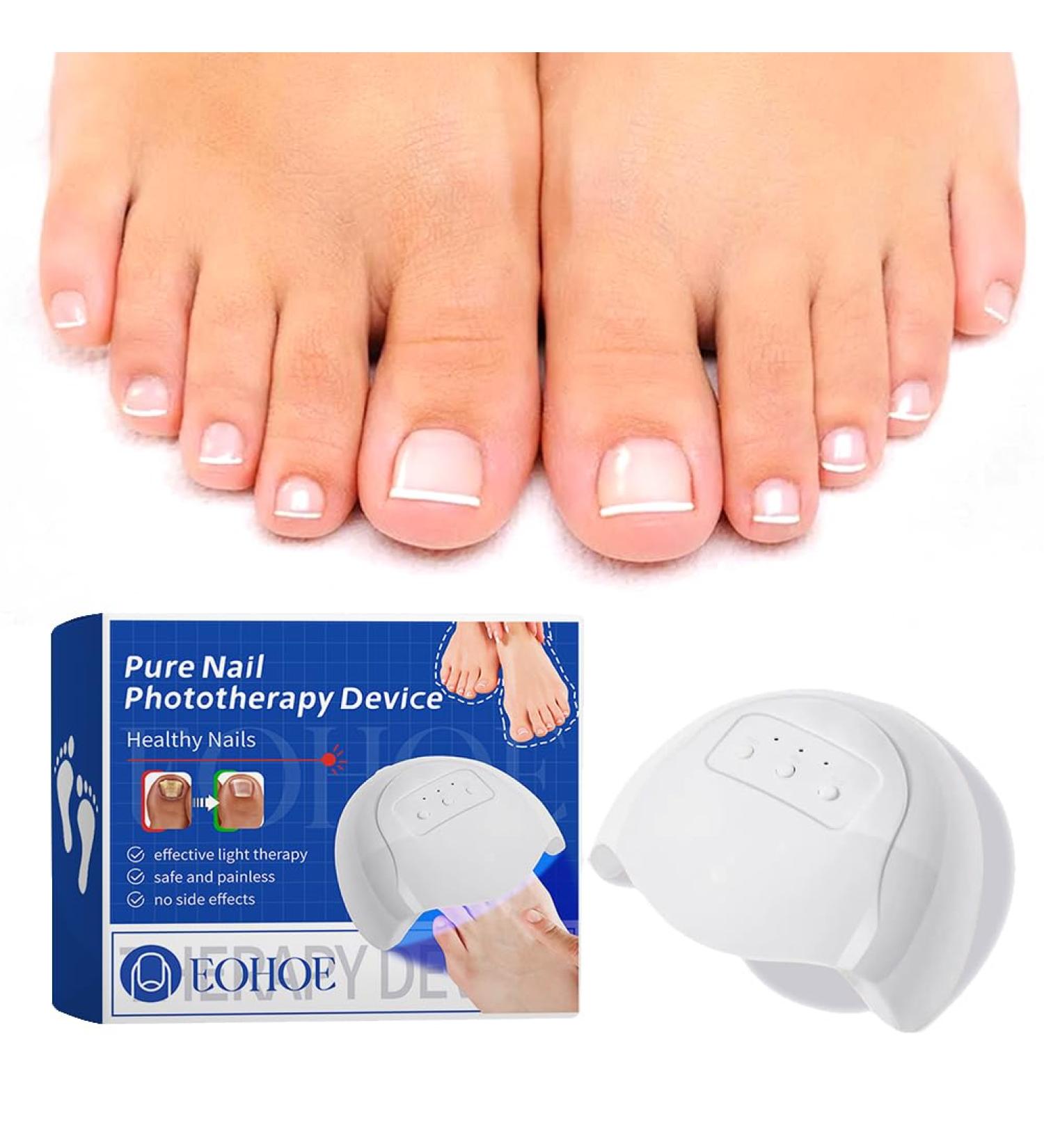 Nail Fungus Laser Device - Fast & Effective Home Treatment for Nail Care | Test Winner for Footpiece Therapy - Buy Online on GoSupps.com