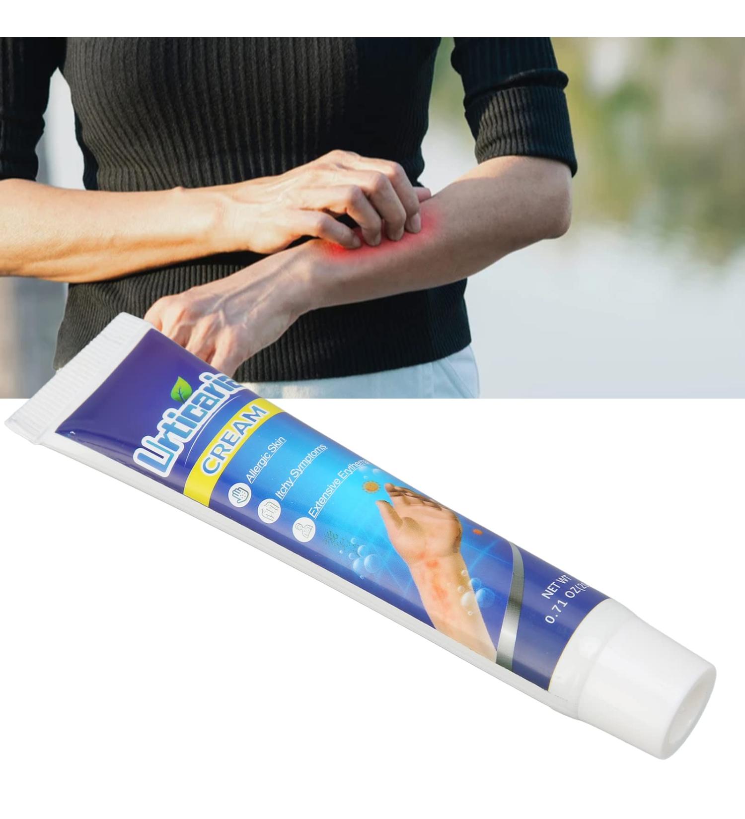 20g Anti-Itch Cream for Urticaria & Pruritus | Adjunctive Treatment for Dry Skin | Soothes Hives & E45 Itch Relief - Buy Online on GoSupps.com