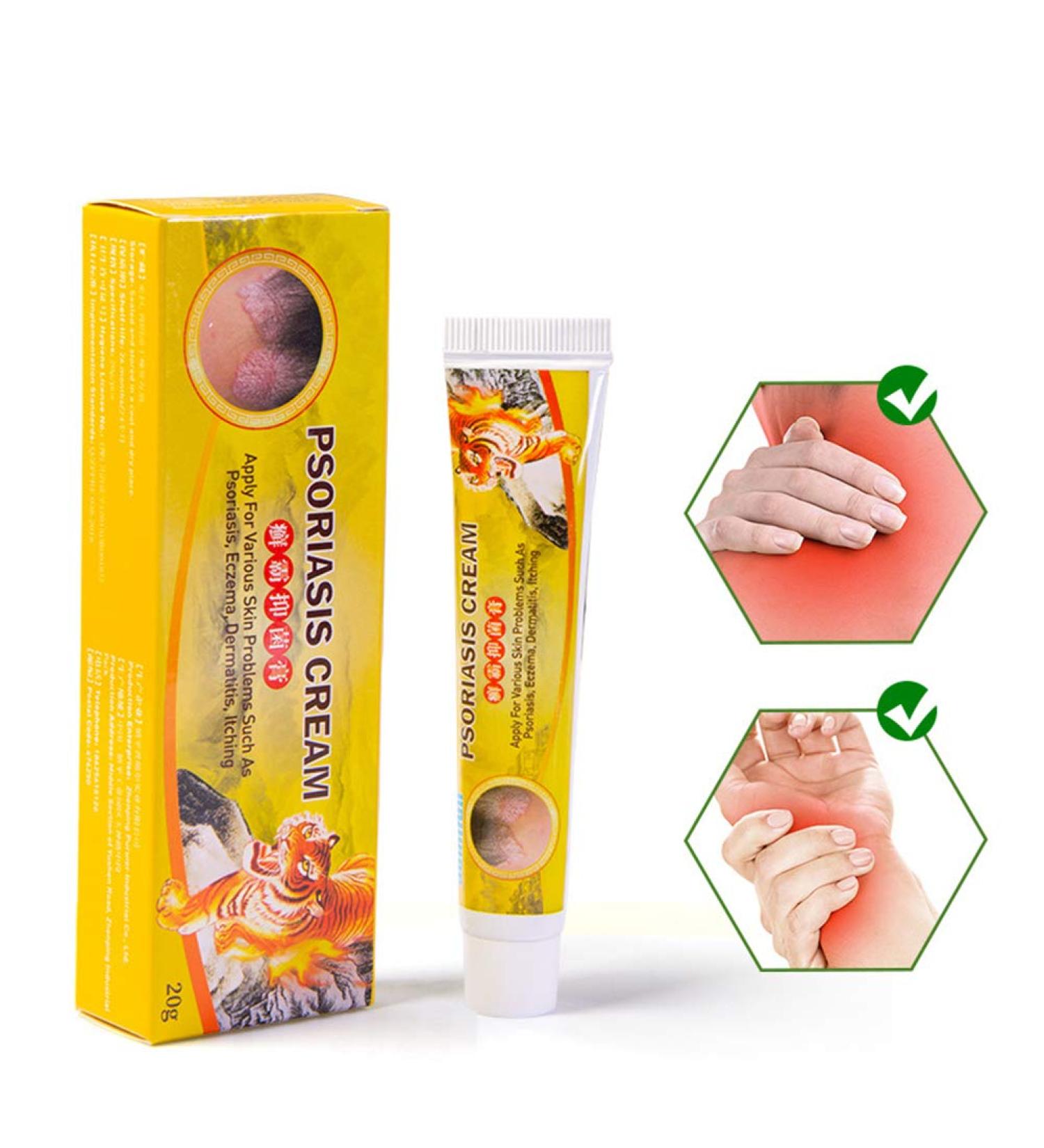 Worglo Ultimate Psoriasis Relief Cream - Soothes Irritated Itching, Controls Reoccurrences, and Comforts Scaling Skin - Buy Online on GoSupps.com