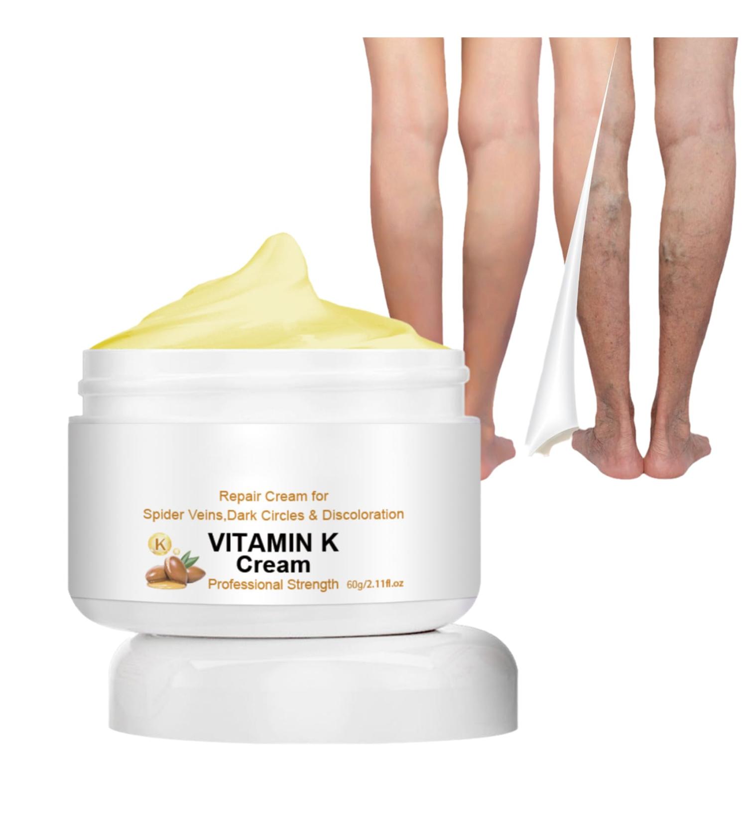 Vitamin K Cream for Varicose Veins - Miracle Cream for Spider Veins & Leg Vein Removal (1pcs) - Fast International Shipping - Buy Online on GoSupps.com
