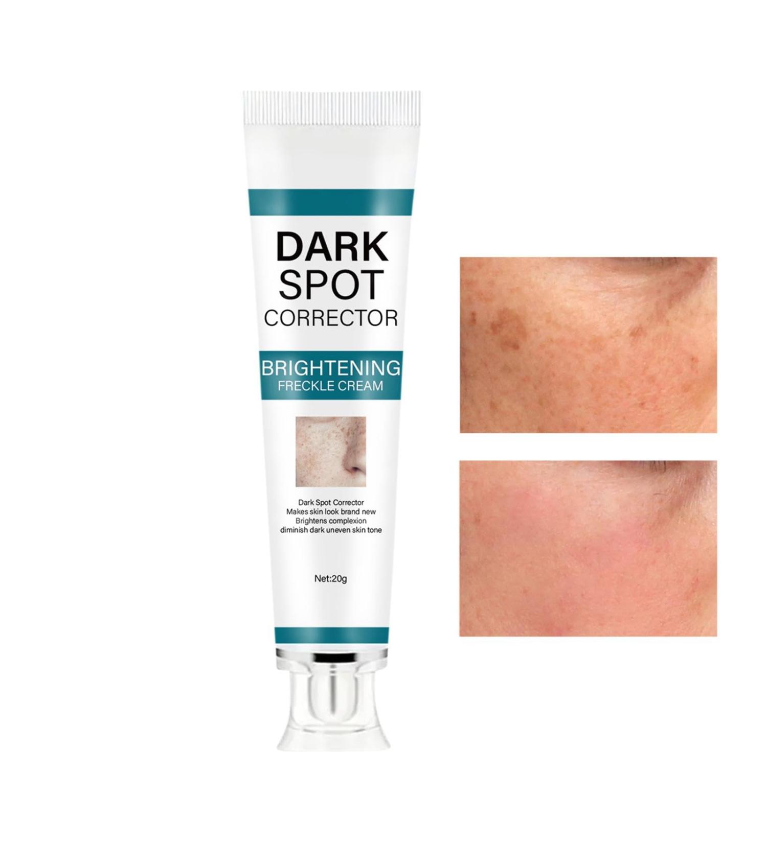 Dark S Corrector Cream Whiten S Moisturizer Skin Brightening Cream Facial Brightening Moisturizer Deep Skin Brightening Skin Tone Corrector Dark Remover Age S Cream - Buy Online on GoSupps.com