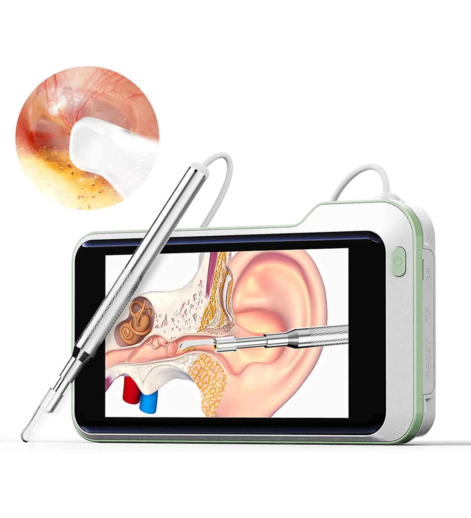 Otoscope Ear Wax Removal Kit 3.9mm HP 5 Inch Screen Digital Otoscope Handheld Visual Ear Cleaning Scope Endoscope Ear Scope for Adults Kids &Pets Green - Buy Online on GoSupps.com