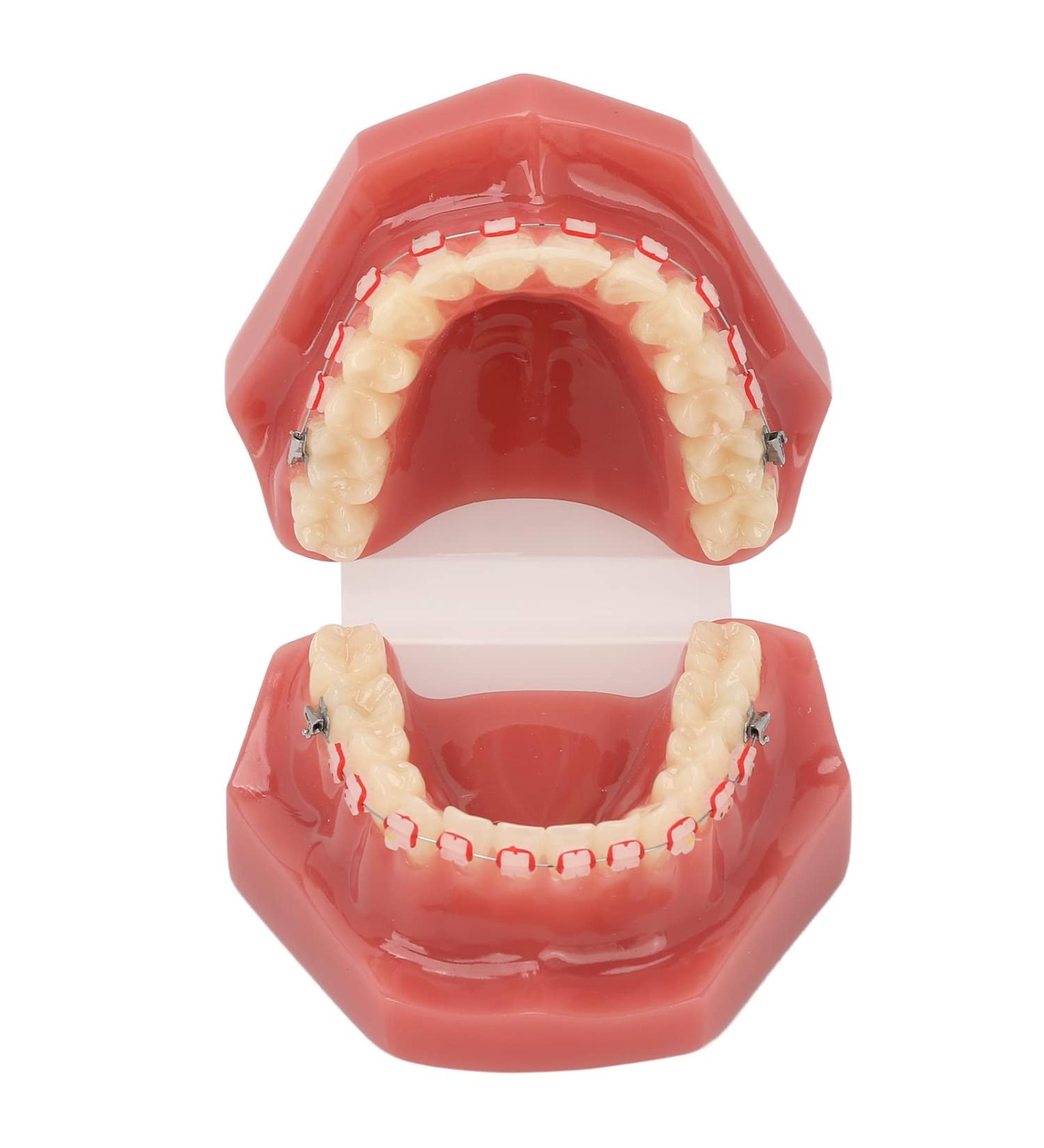 Ververt Touch Ceramic Dental Orthodontic Model - Tooth Demonstration Model with Metal Wires & Bracket for Teaching & Learning - Buy Online on GoSupps.com
