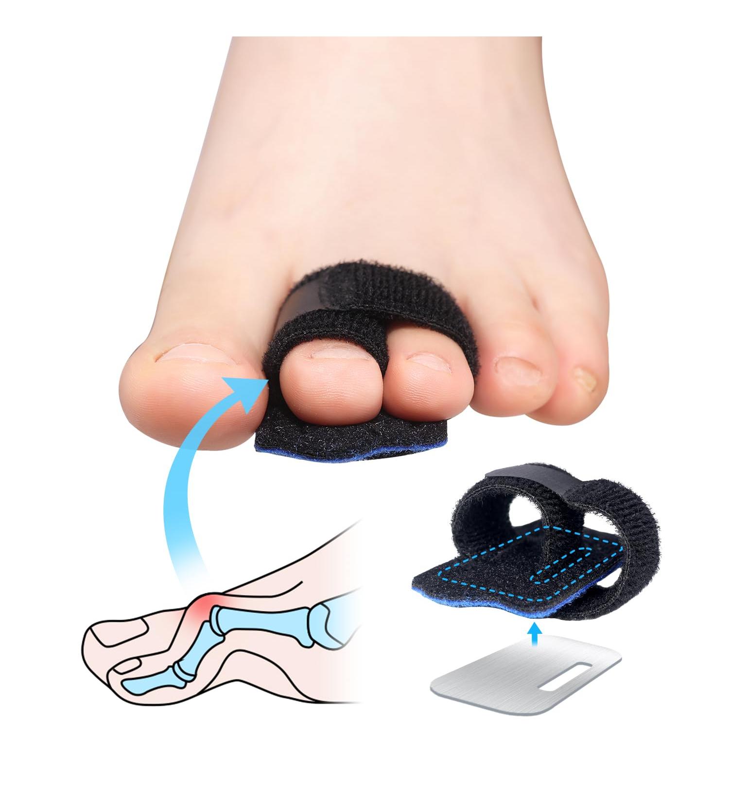 Hammer Toe Straightener -1