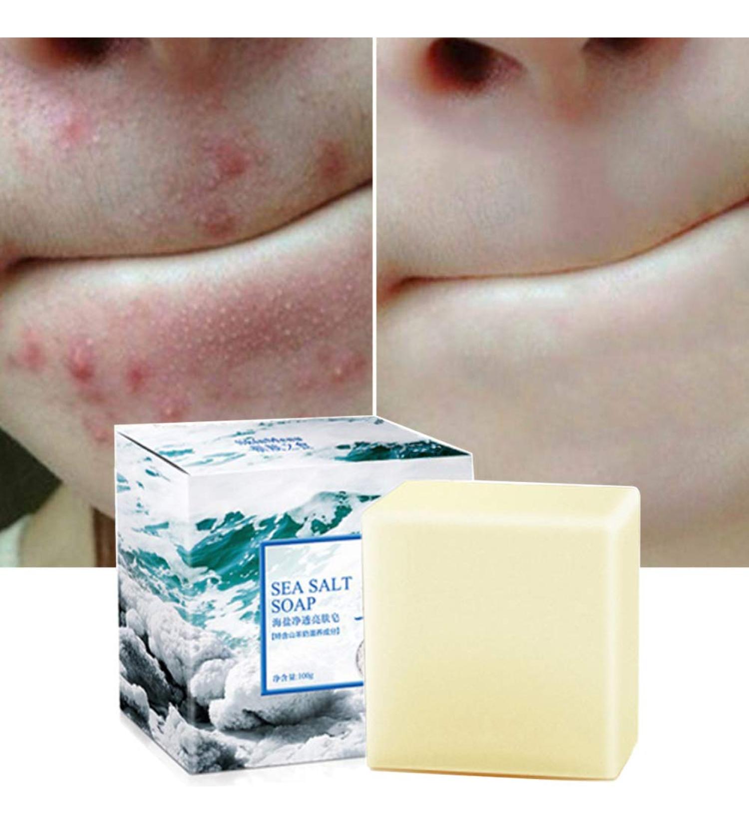 Goat's Milk Sea Salt Soap for Face - 3.52 Oz - Remove Acne & Fight Cellulite - For Dry & Oily Skin - Buy Online on GoSupps.com