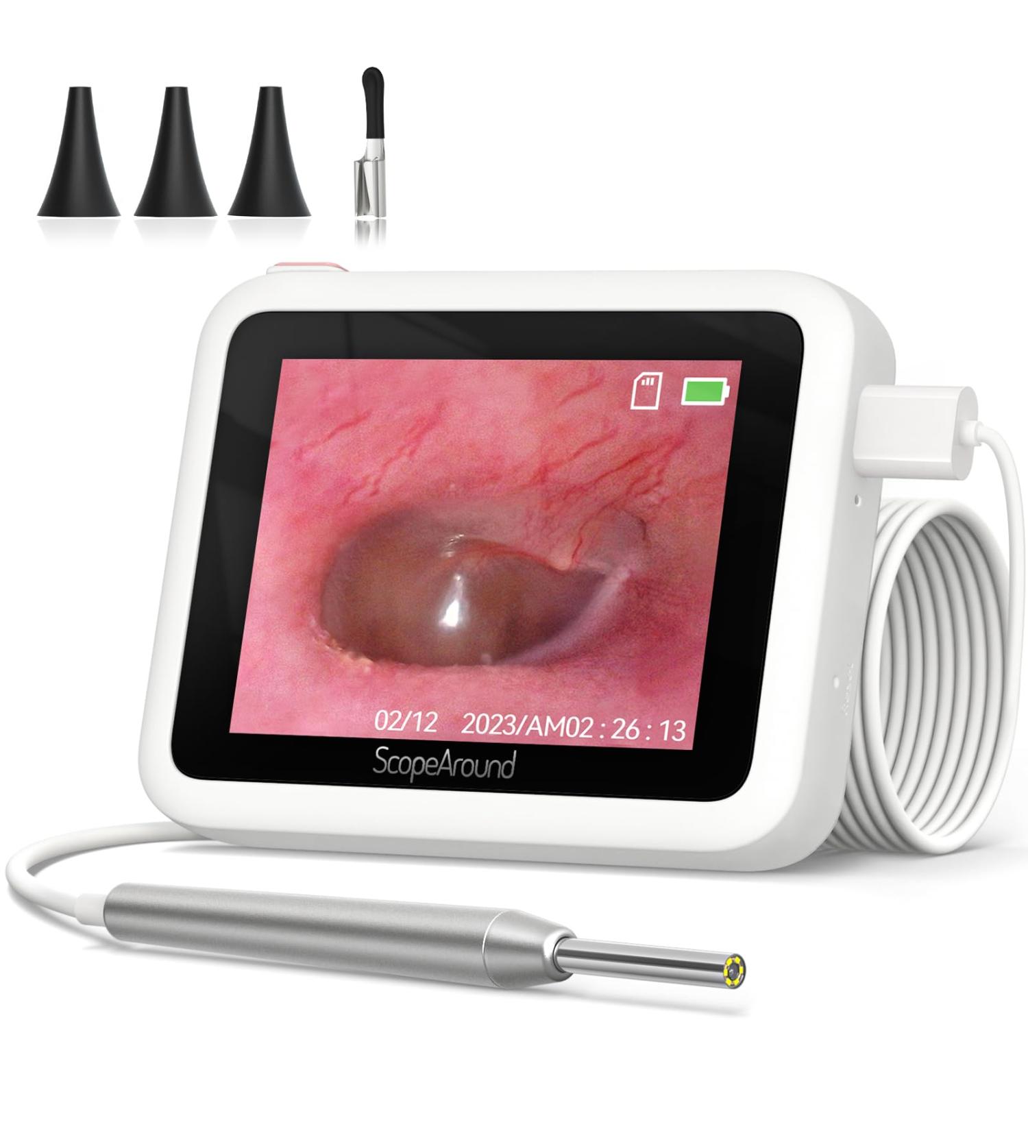 ScopeAround Otoscope with 2.8-Inch HD IPS Screen - 3.9mm HD Otoscope with Light for Clear Ear Inspections | International Shipping Available - Buy Online on GoSupps.com