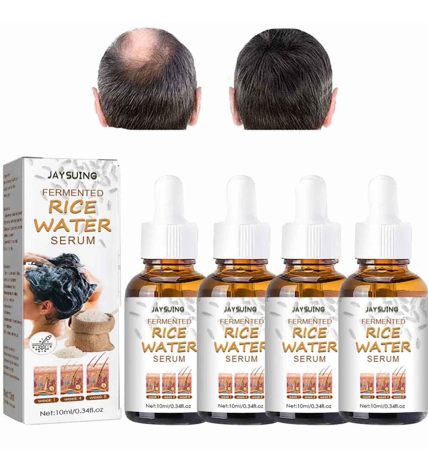 Rice Water Hair Essence for Growth & Anti-Hair Loss | Fermented Serum for Nourishing Hair & Visible Results in 4 Weeks - Buy Online on GoSupps.com
