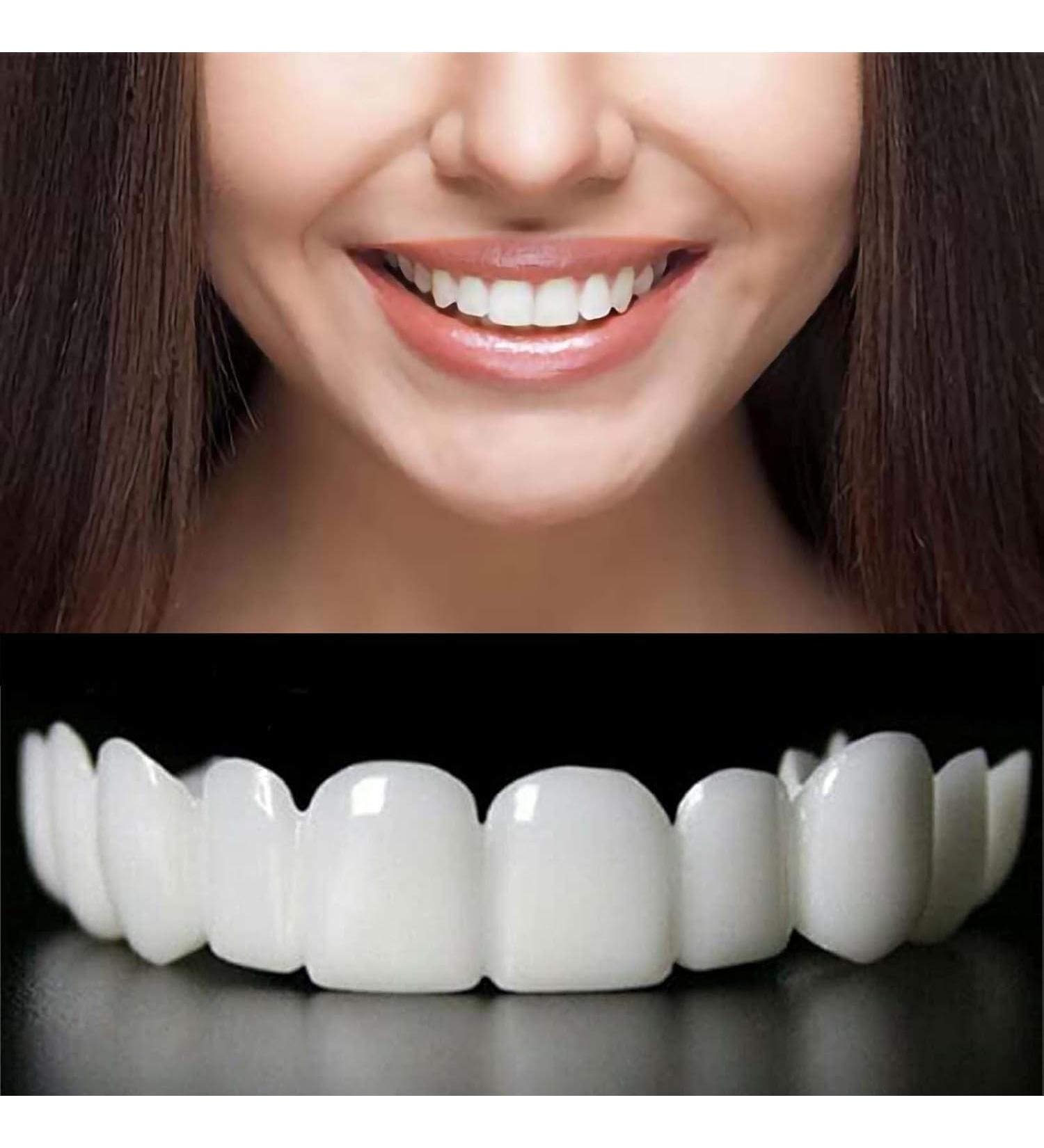 Adjustable Smile Supports - 2 Pairs (Top & Bottom) | Comfortable & Secure Fit - Buy Online on GoSupps.com