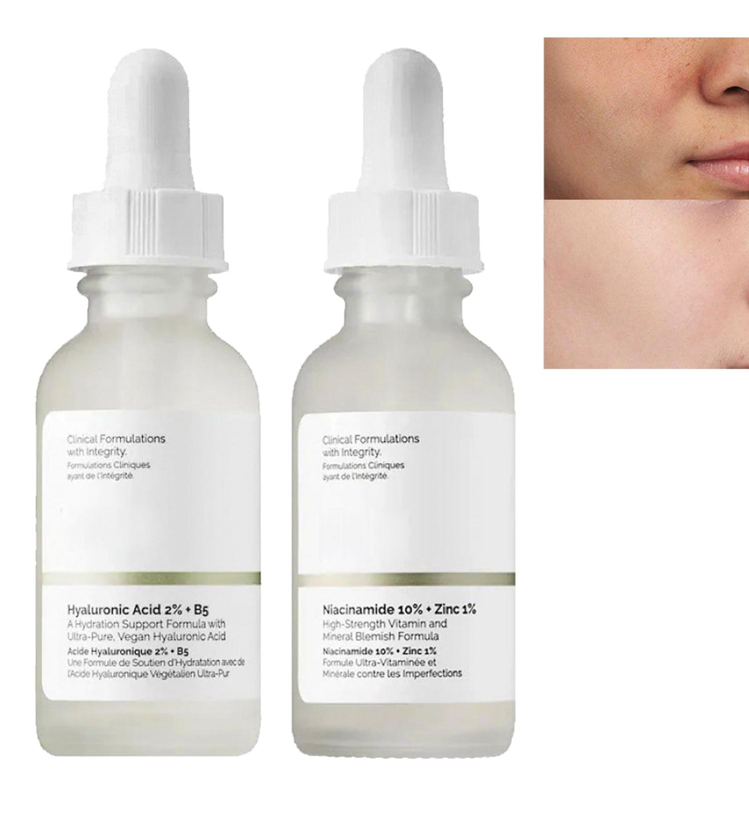 Niacinamide10%+Zinc 1% & Hyaluronic Acid 2% + B5 Skincare Serum Face Serum for Women & Men Face Moisturizer Set Dark Spot Remover for Face Lightweight Face Serum Tackles Blemishes Minimises Pore - Buy Online on GoSupps.com