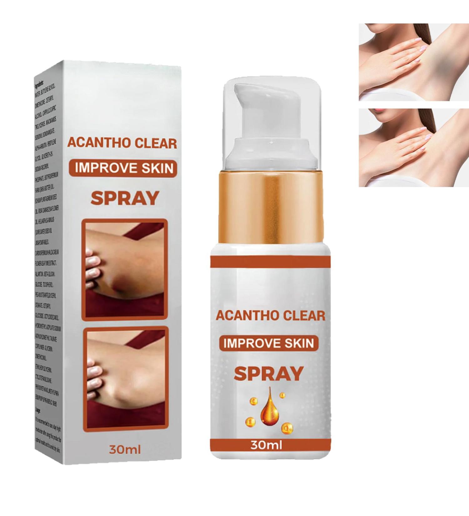 GHEART Acanthoclear Therapy Spray Acanthosis Nigricans Treatment Dark Knuckle Whitening Serum Dark Knuckle Whitening Serum Spray Dark Knees and Elbows Strong Whitening Essence Spray 30ml - Buy Online on GoSupps.com