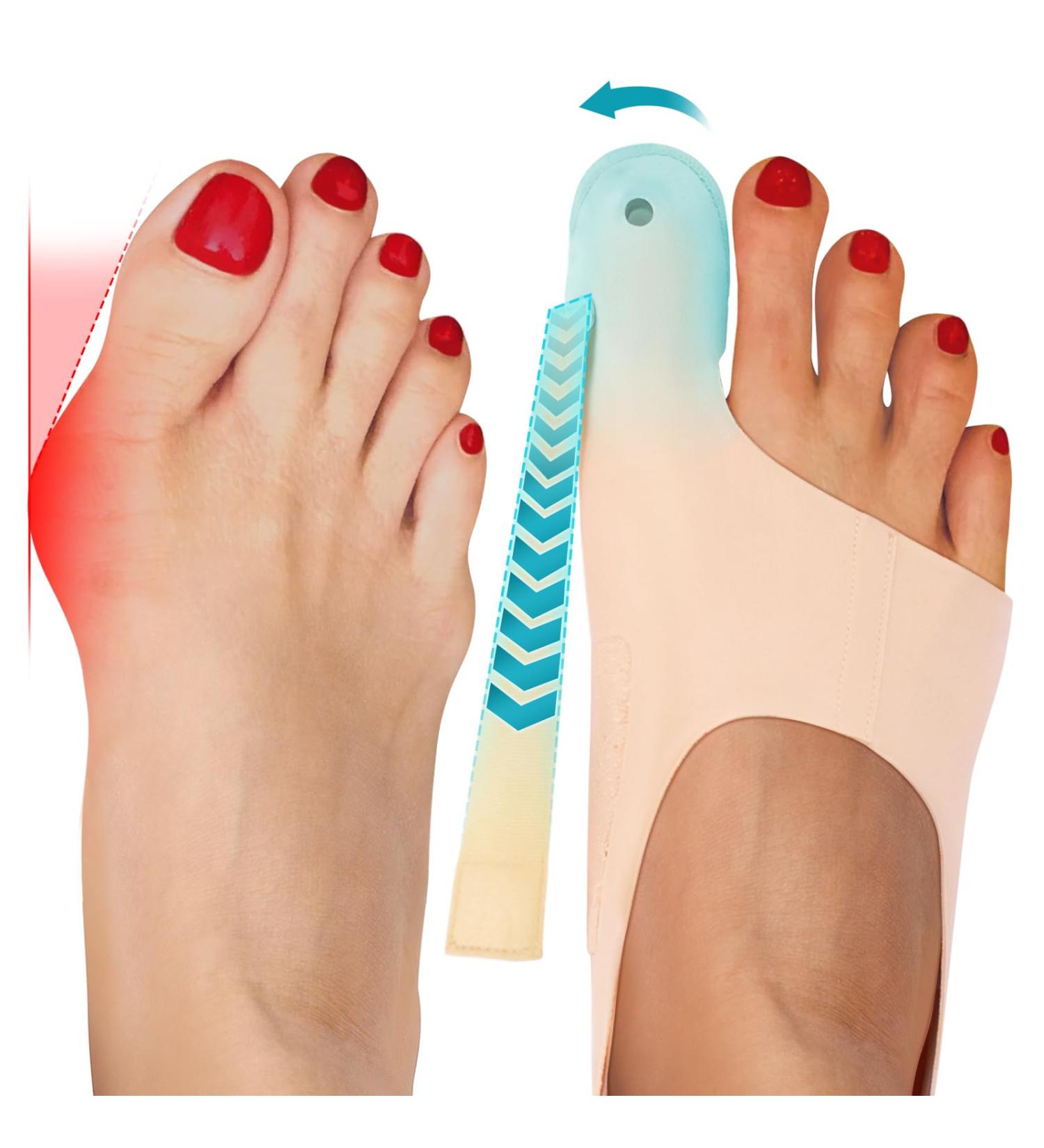 Tech Love Hallux Valgus Socks - Bunion Relief Non-Slip Heel Strap Splint Size M for Shoes | International Shipping - Buy Online on GoSupps.com