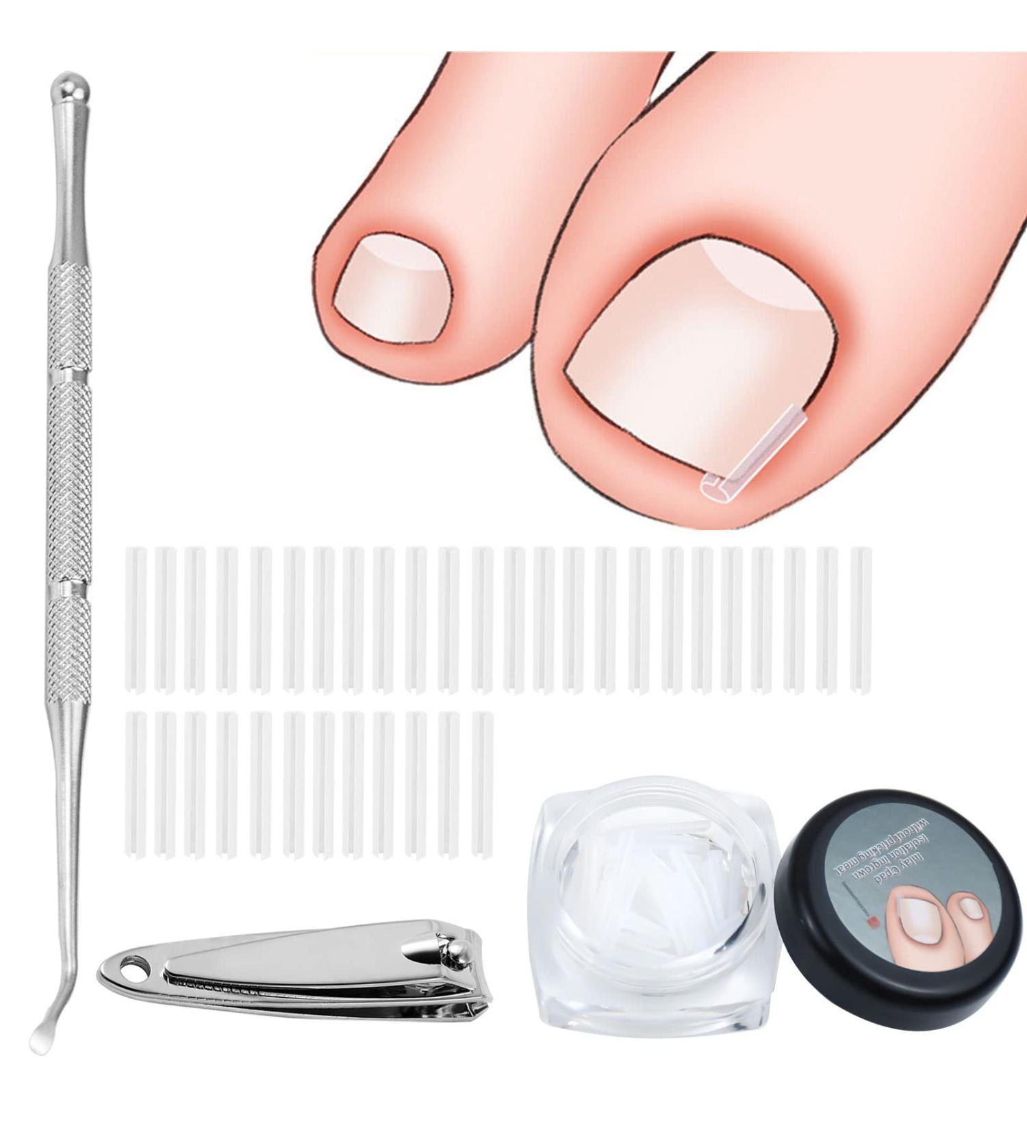 52 Pcs Ingrown Toenail Correction Strips Brace Kit Ingrown Toenail Corrector Toenail Correction Patches Ingrown Toenail Treatment Toenail Straightener Strips with Nail Clipper for Women Men Foot Care - Buy Online on GoSupps.com