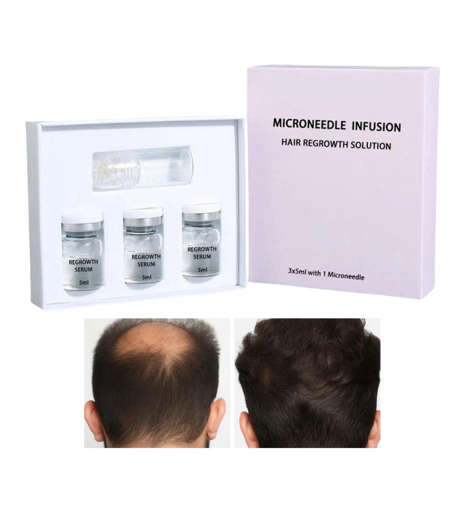Natural Hair Growth Oil Daily Oil Natural Fluid With Vegetable Extracts Scalp Care Promoting Regrowth For Adults Men Women - Buy Online on GoSupps.com