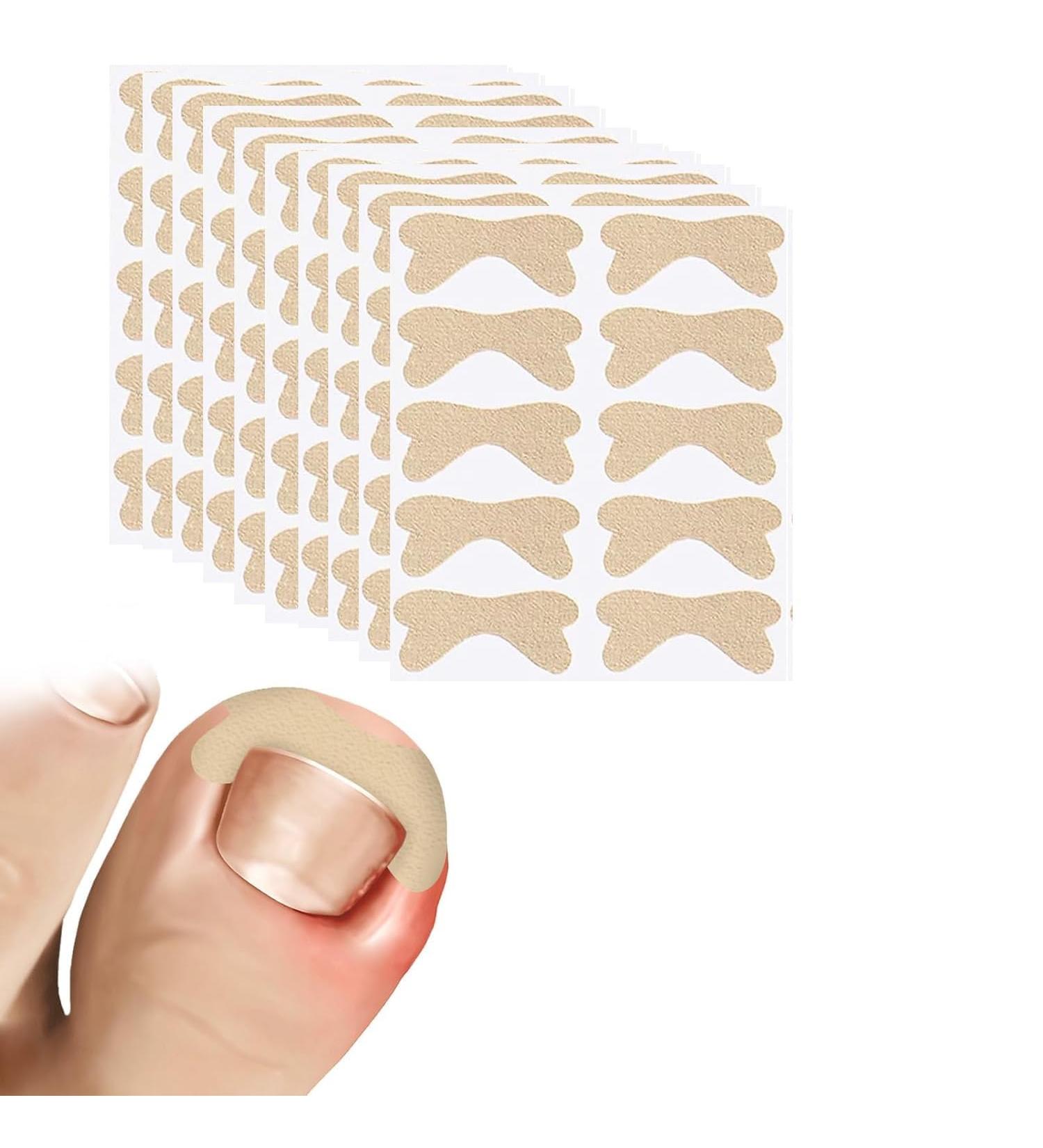 Ingrown Toenail Treatment - 100Pcs Breathable Corrector Patches & Strips | Pain-Free Nail Correction Durable Light Brown Stickers for Effective Ingrown Nail Care - Buy Online on GoSupps.com