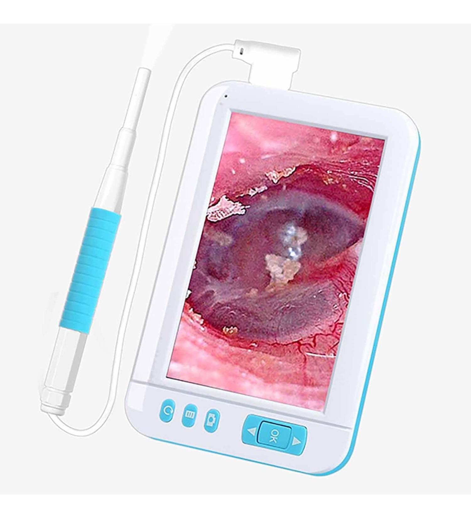 HSRG Portable Digital Otoscope - HD 1080p Ear Cleaner with 3.9mm Lens 4.3 IPS Screen & 6 LED Lights | Ideal for Adults Kids & Pets - Shop Internationally! - Buy Online on GoSupps.com