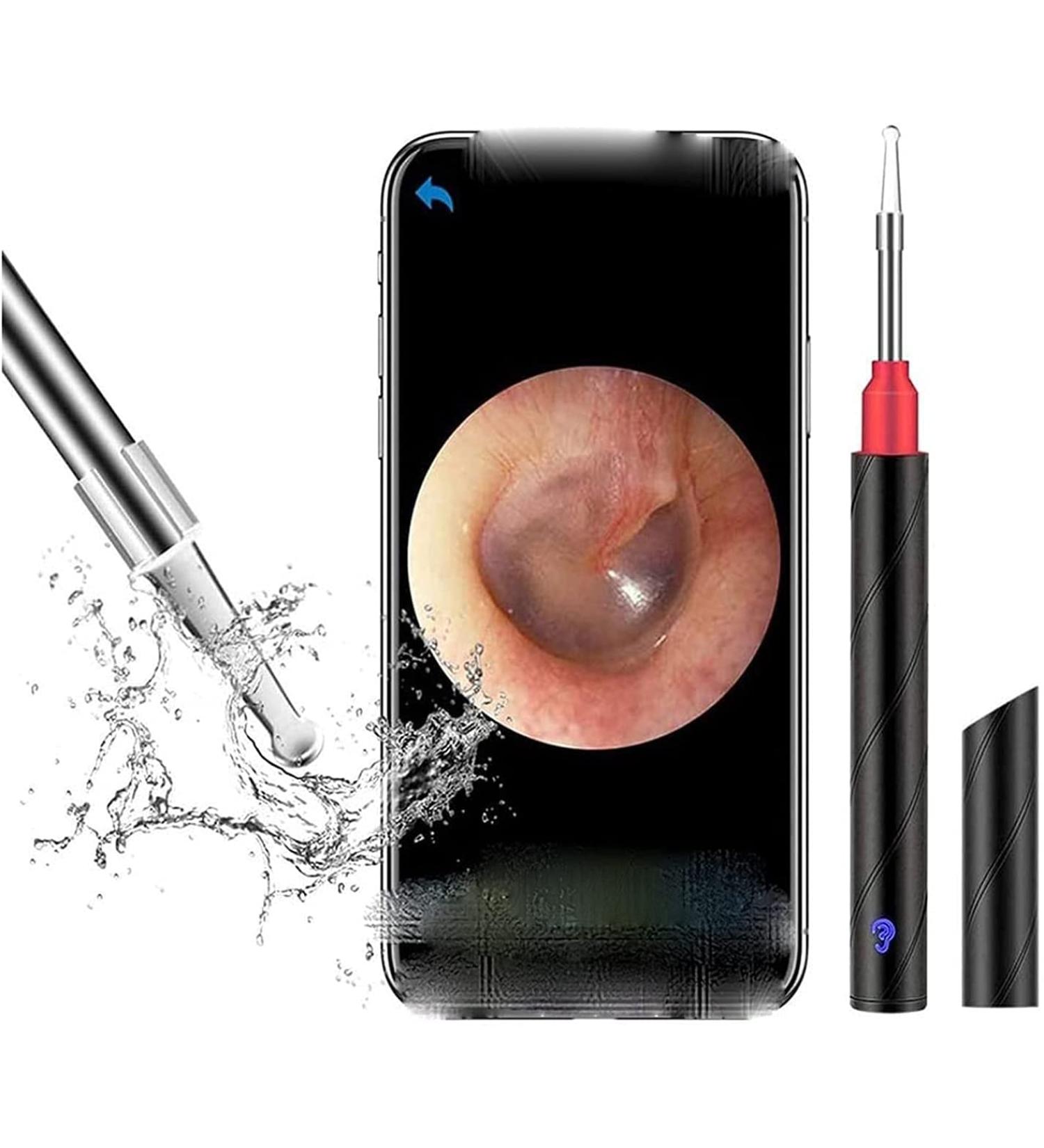SMSOM Ear Wax Removal Ear Cleaner 1920P HD Wireless Ear Otoscope Earwax Removal Tool Safe Ear Wax Removal Kit for Adults Kids &Pets Black - Buy Online on GoSupps.com