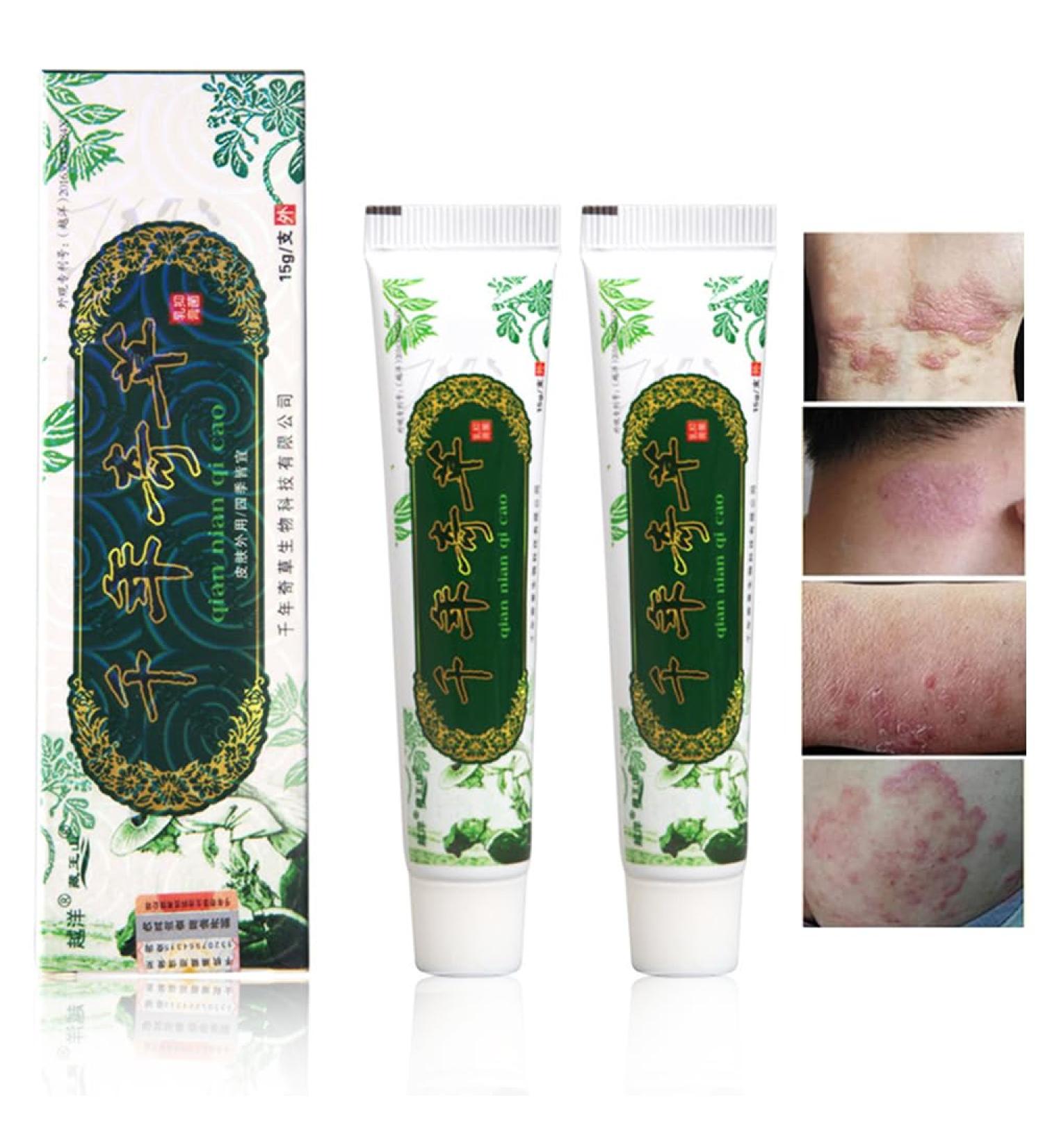 Amzfly Oversea Thousand-Year Herbal Cream Chinese Herbal Eczema Psoriasis Creams Dermatitis and Eczema Pruritus Psoriasis JIULIN Ointment (2PCS) - Buy Online on GoSupps.com