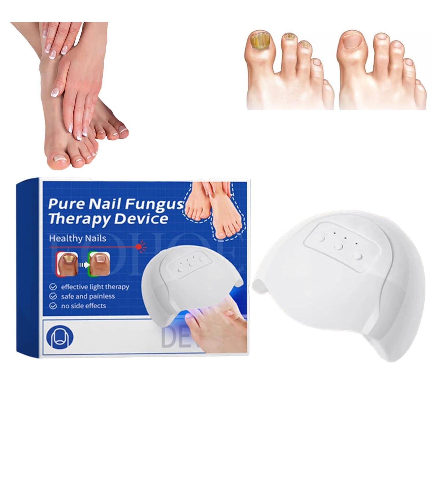 Furzero Pureail Nail Fungus Laser Therapy Device - Effective Fungus Treatment for Healthy Nails | Fast International Shipping - Buy Online on GoSupps.com