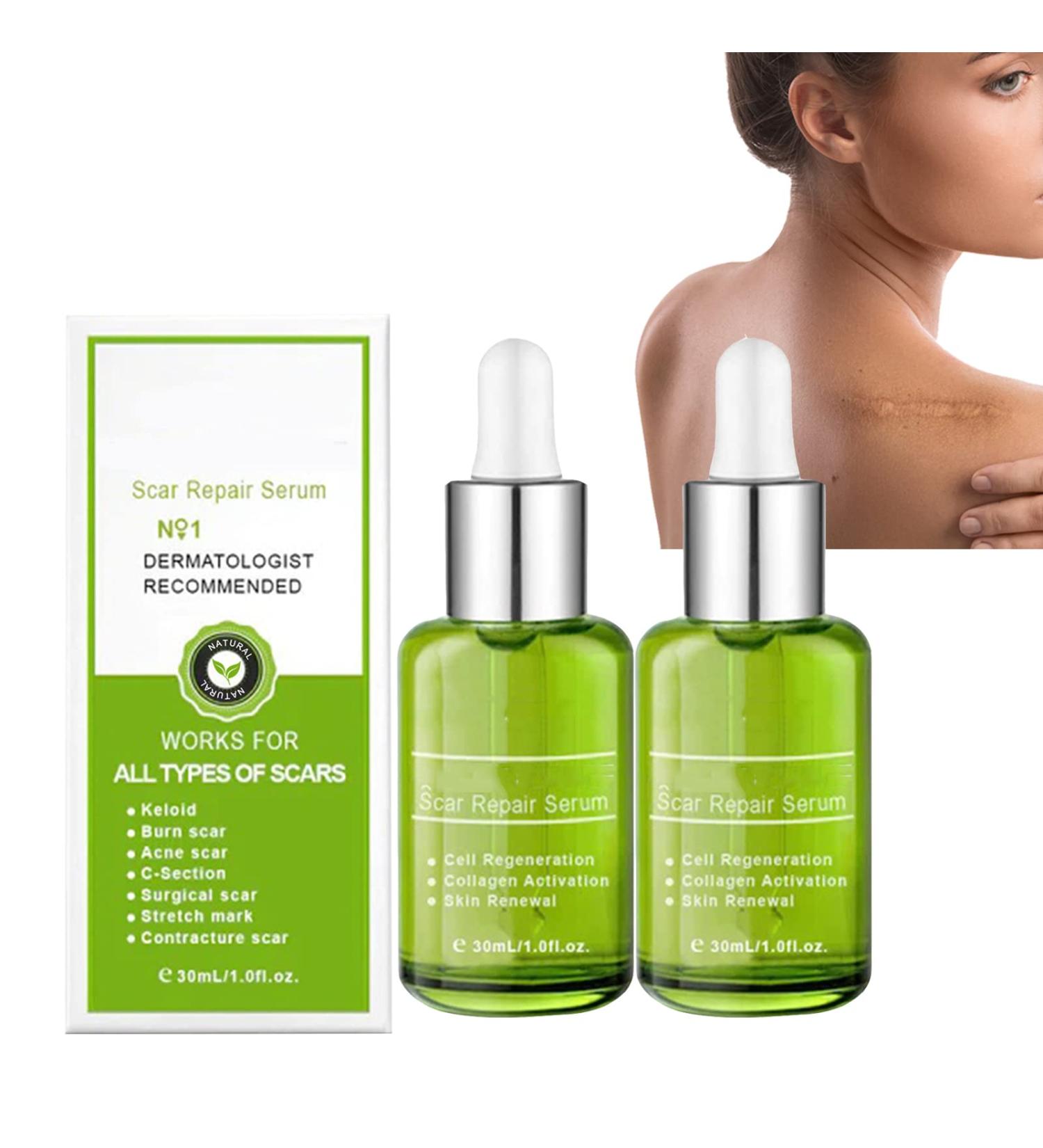 Goopgen Advanced Scar Repair Serum - Effective Scar Removal Spray for All Types of Scars - Buy Online on GoSupps.com