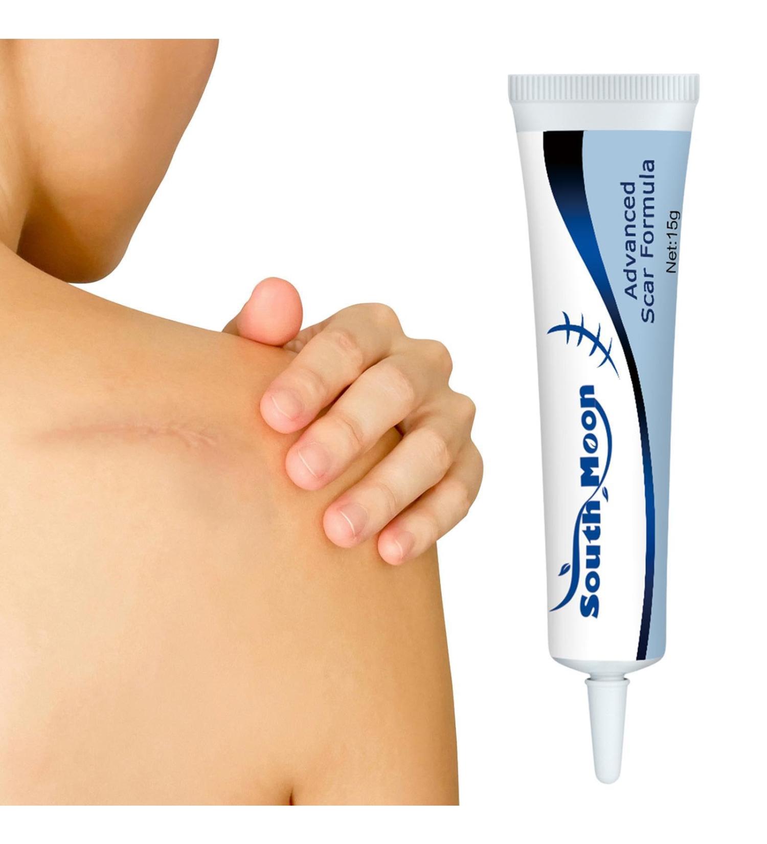  Streysisl Scar Gel Cream | Scar Remover for Old and New Scars - Nourishing Healing Treatment for Surgical Scars Section C - Buy Online on GoSupps.com