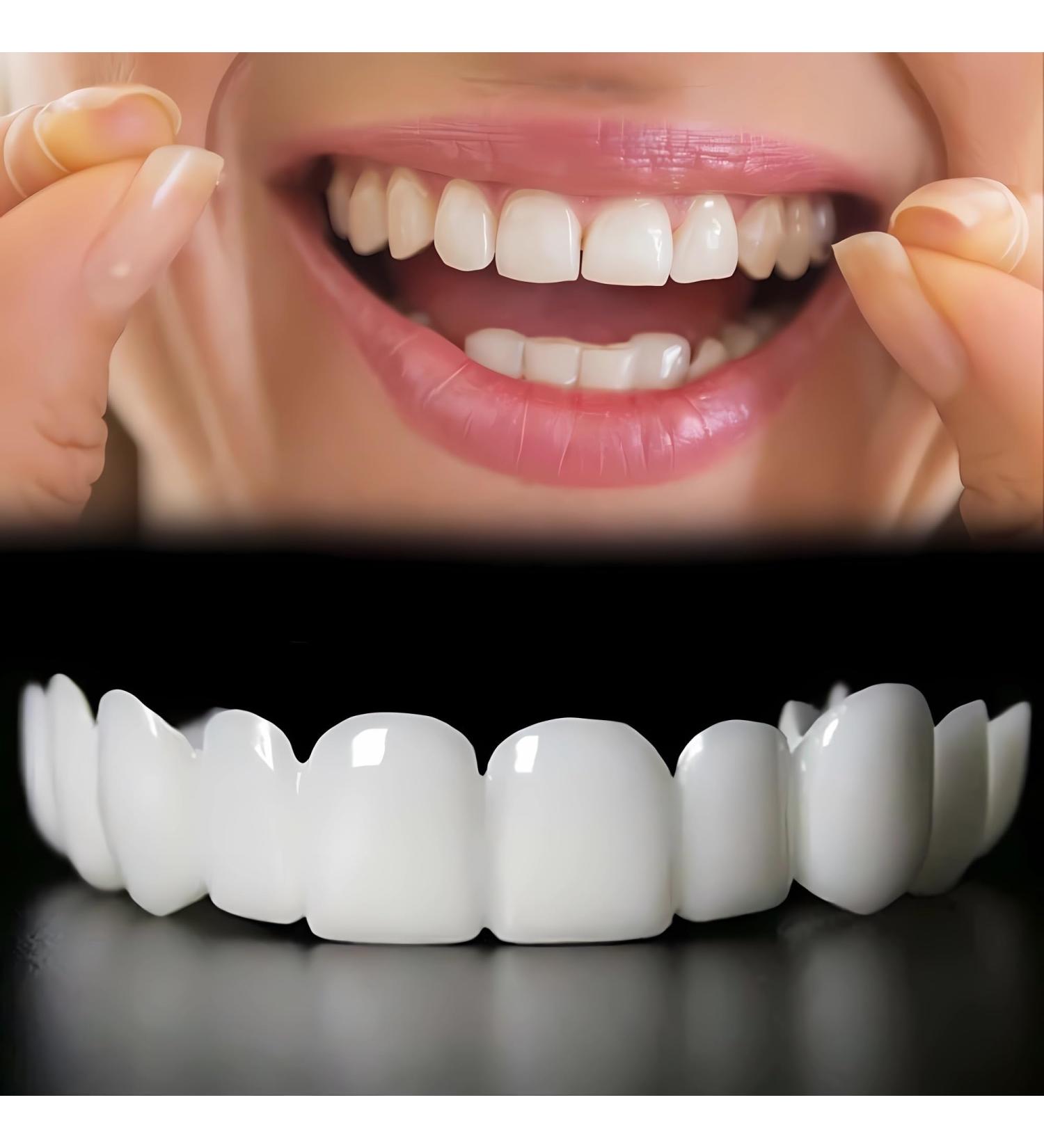 2 Pairs Temporary Smile Solution Adjustable & Comfortable.(White) (11) - Buy Online on GoSupps.com