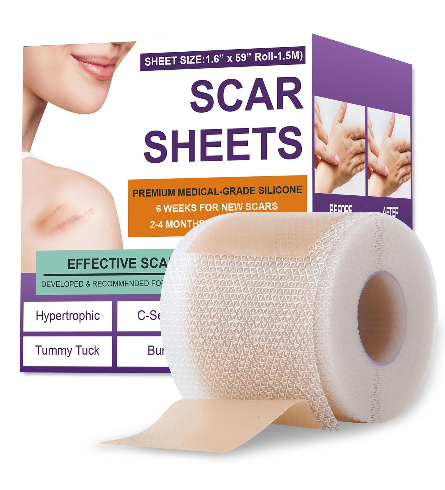 Silicone Scar Sheets & Tape | Effective Scar Removal for Surgical & Keloid Scars - 1.6 x 59 Roll (1.5M) - Fast International Shipping - Buy Online on GoSupps.com