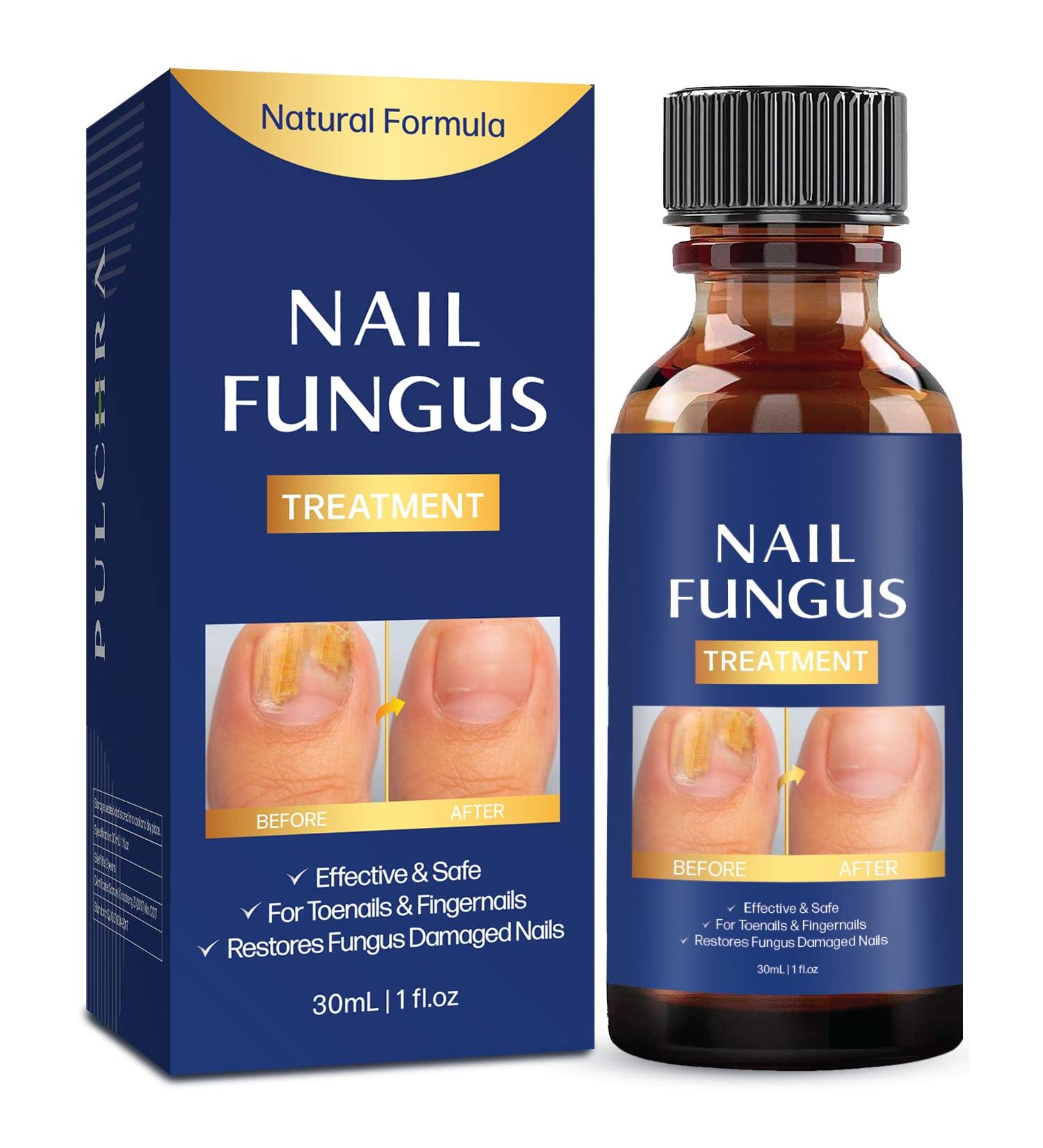 Extra Strength Toe Nail Fungus Treatment - Effective Nail Repair Solution for Healthy Nails - Buy Online on GoSupps.com