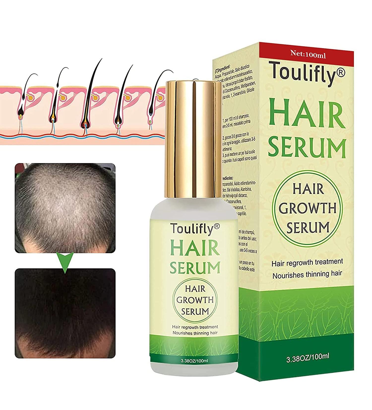 Hair Growth Serum - Stop Hair Loss and Thinning, Promote Stronger New Hair Growth | Natural Herbal Essence Treatment - Buy Online on GoSupps.com