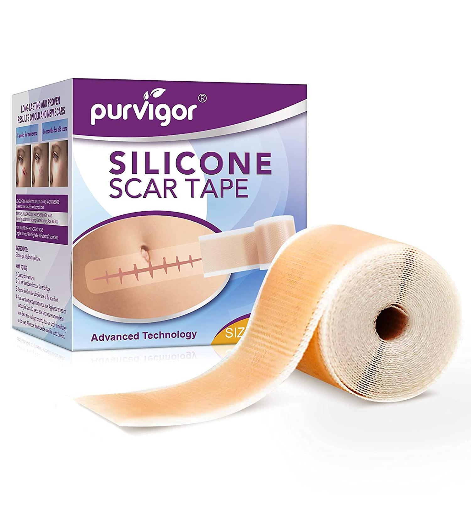 Medical Grade Silicone Scar Sheets - 1.6 x 60 Reusable Gel Tape for Acne, C-Section, Keloid Surgery Scars Treatment - Buy Online on GoSupps.com