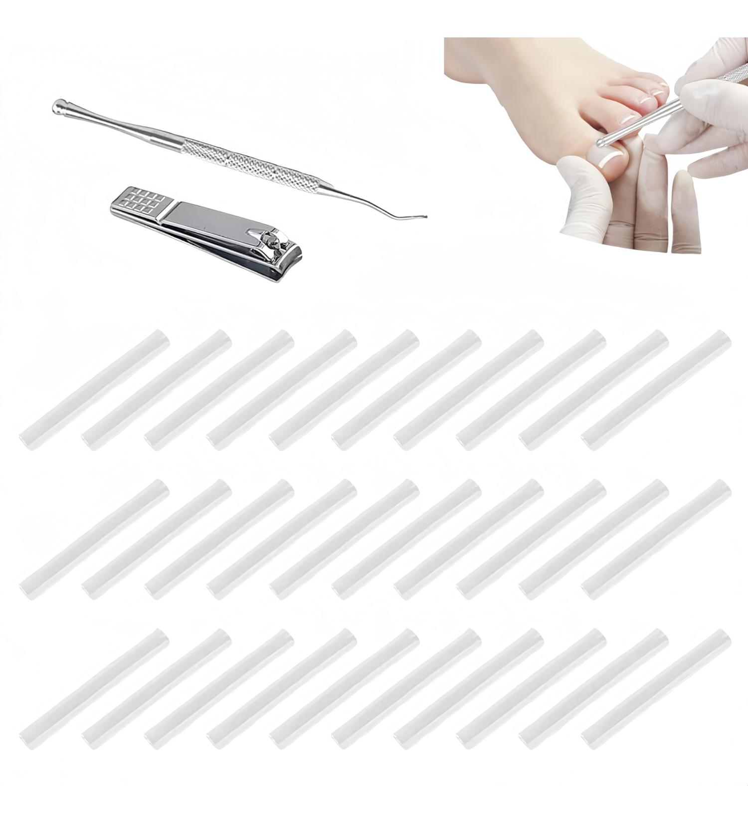Corrective for Ingrown Nails Correction of Ingrown Nails Correction Kit 30 Pieces Correction Strips for Ingrown Nails Toe Nail Correction - Buy Online on GoSupps.com
