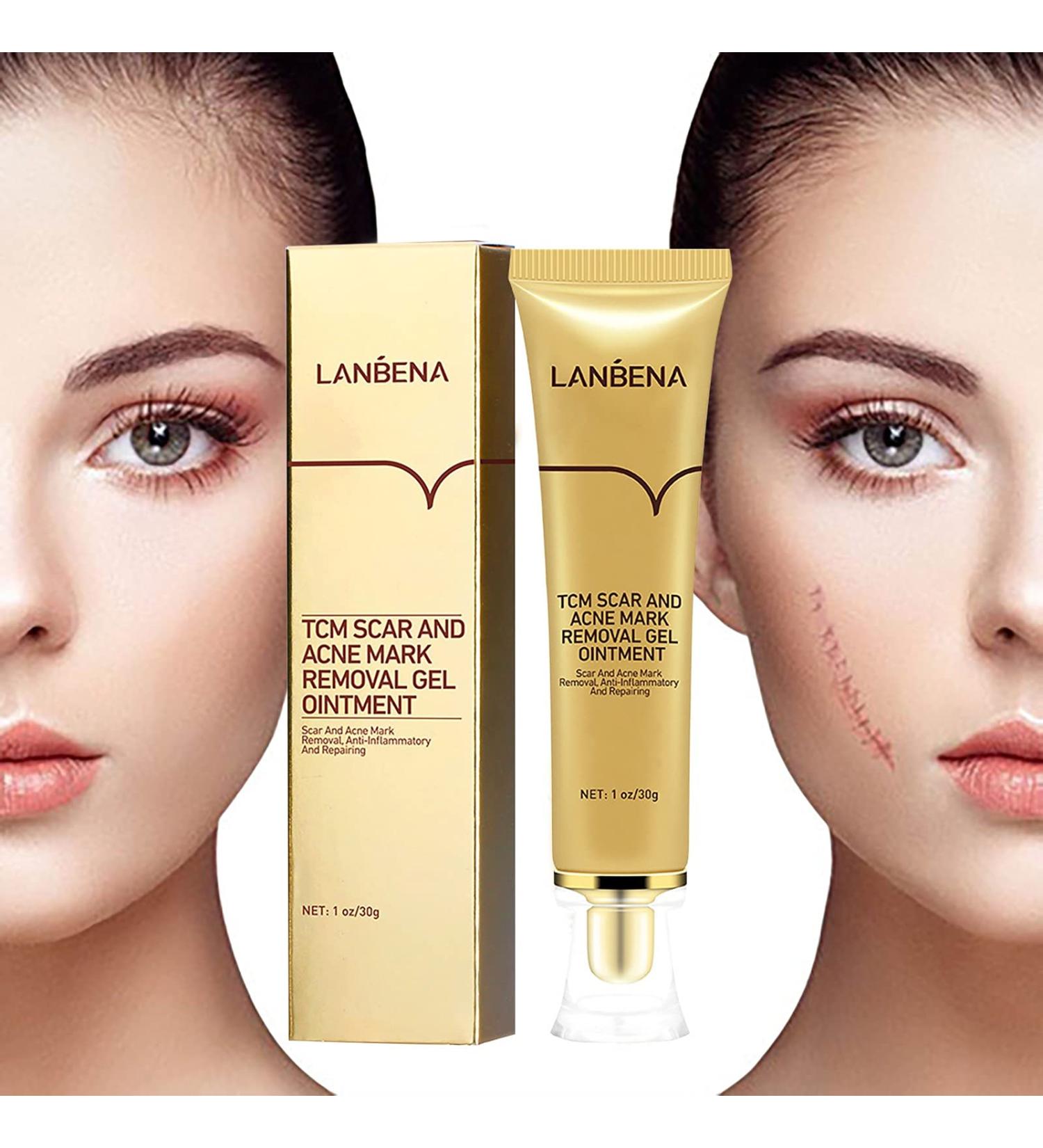 Effective Scar Removal Treatment for Spots & Stretch Marks - Shop Now | One Size B - Buy Online on GoSupps.com