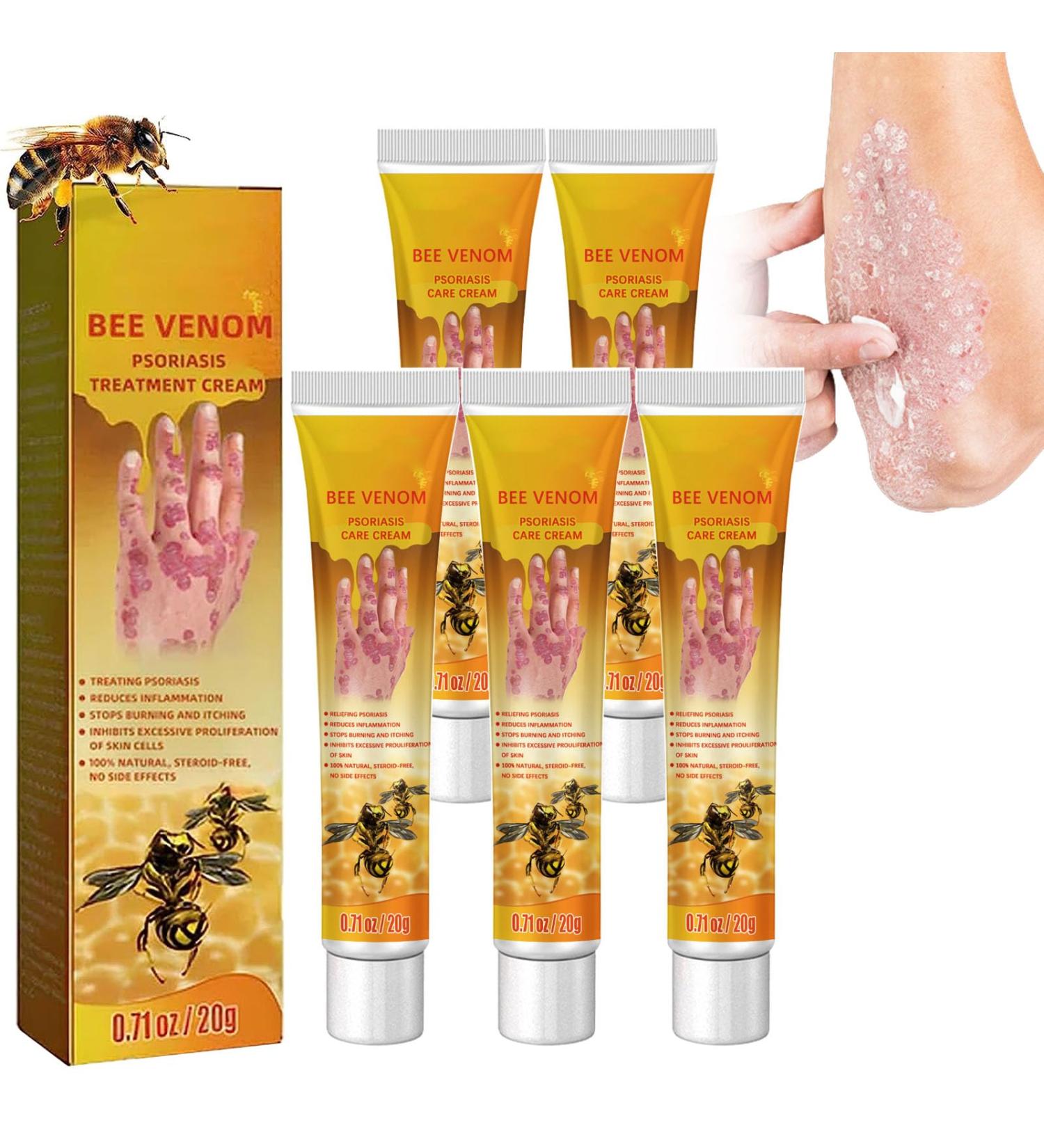 New Zealand Bee Venom Psoriasis Treatment Cream - 5pcs | Professional Solution for All Skin Types - Buy Online on GoSupps.com