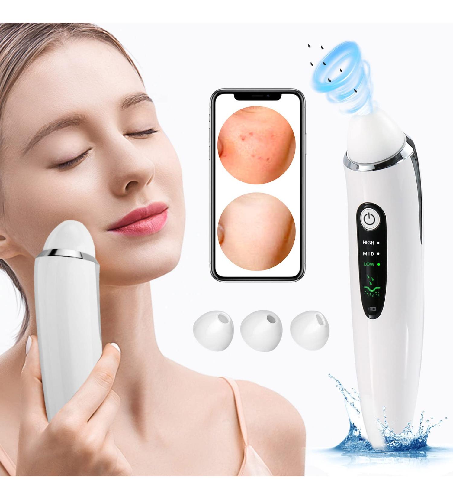 EXEMPT Blackhead Remover Vacuum with Camera - Pore Vacuum & Pimple Popper Tool Kit for Acne Extraction - Skin Care Suction Tool for Women Men - Buy Online on GoSupps.com