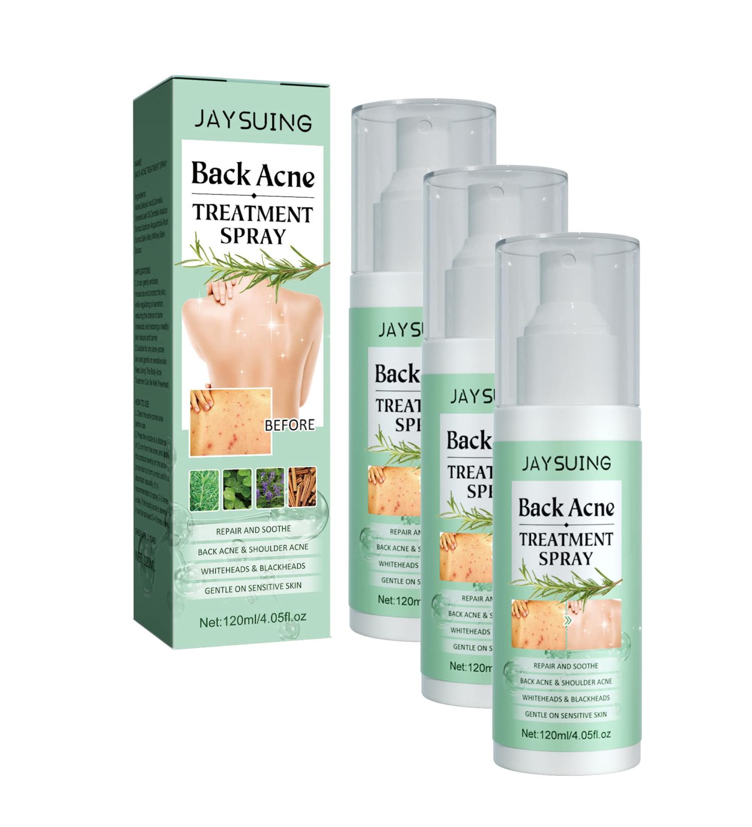 Missdong Back Acne Treatment Herbal Spray - 2023 New Formula for Back & Chest - 3pcs - Buy Online on GoSupps.com