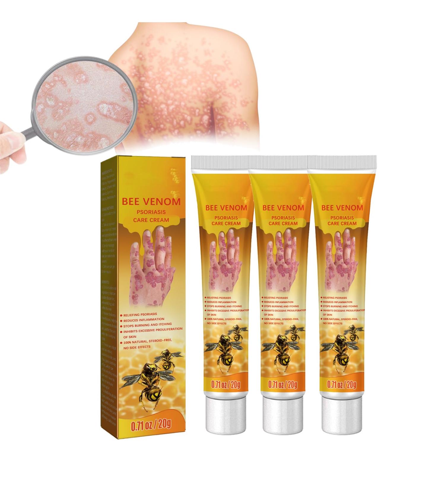 HEKEWER Bee Venom Psoriasis Treatment Cream Set - Soothing Relief for All Skin Types - Buy Online on GoSupps.com