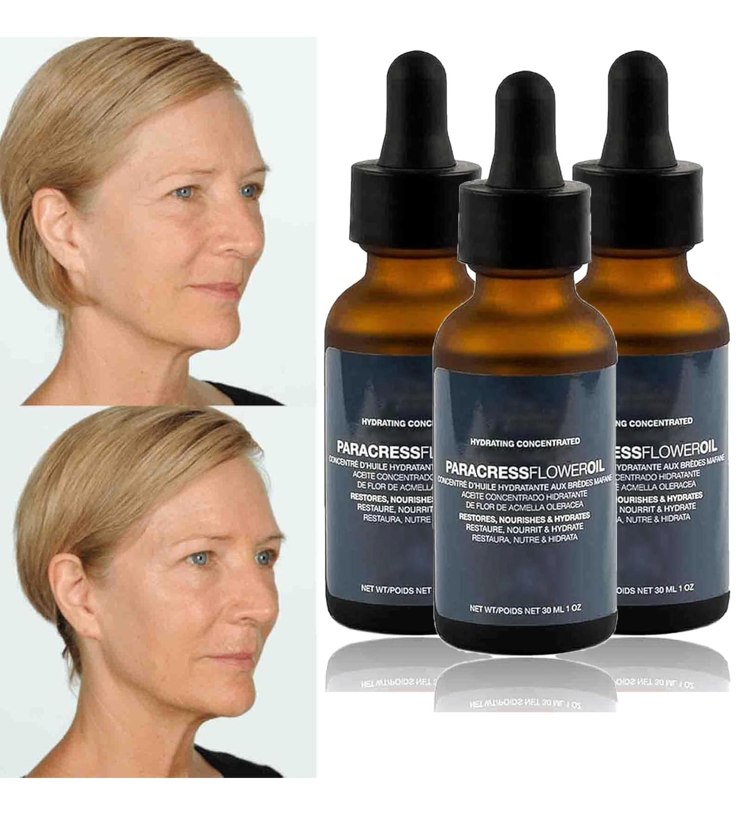 Paracress Facial Oil 30ml Paracress Oil Paracress Serum Paracress Facial Serum Organic Huile pour le visage de paracresse s rum de paracresse s rum pour le visage de paracresse biologique (3Pcs) - Buy Online on GoSupps.com