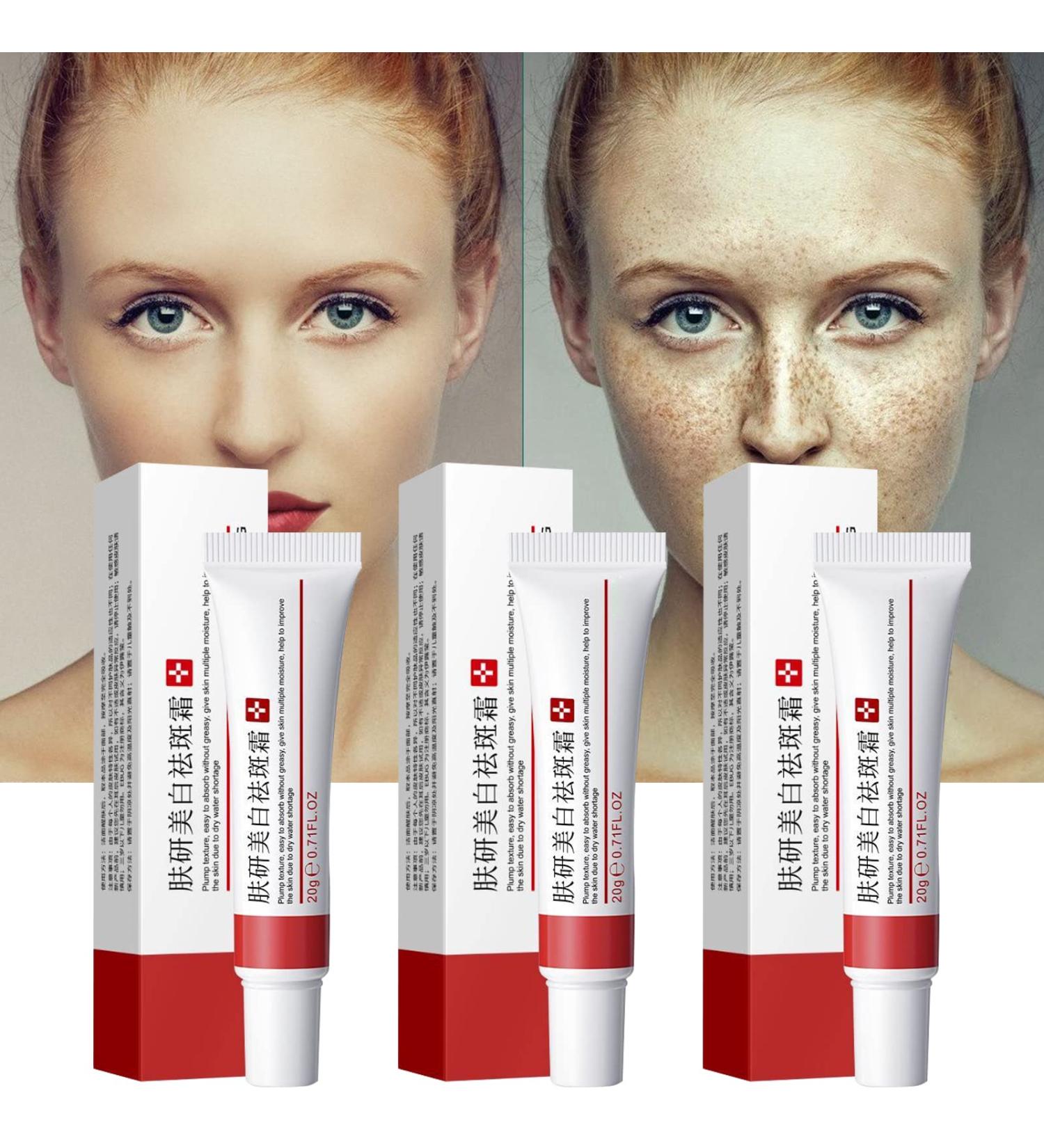 Dark Spot Remover for Face - 3PCS Dark Spot Corrector Cream for All Skin Tones - Melasma, Freckle, Sun Spot Remover & Blemish Reducer 2.1 FL OZ - Buy Online on GoSupps.com
