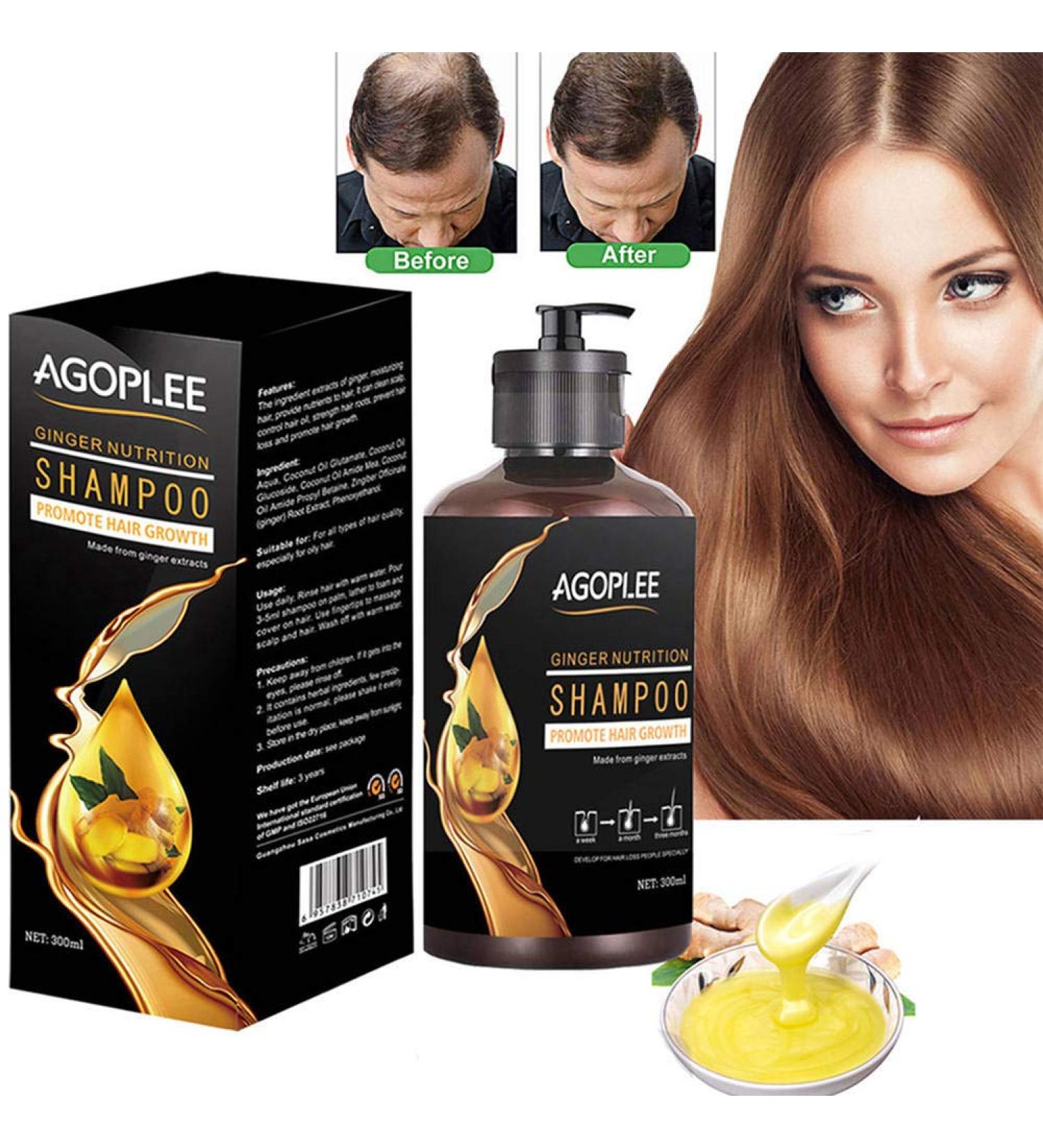 Natural Hair Loss Treatment Shampoo - Promotes Hair Growth & Prevents Loss - Old Ginger Formula - 10OZ - Buy Online on GoSupps.com