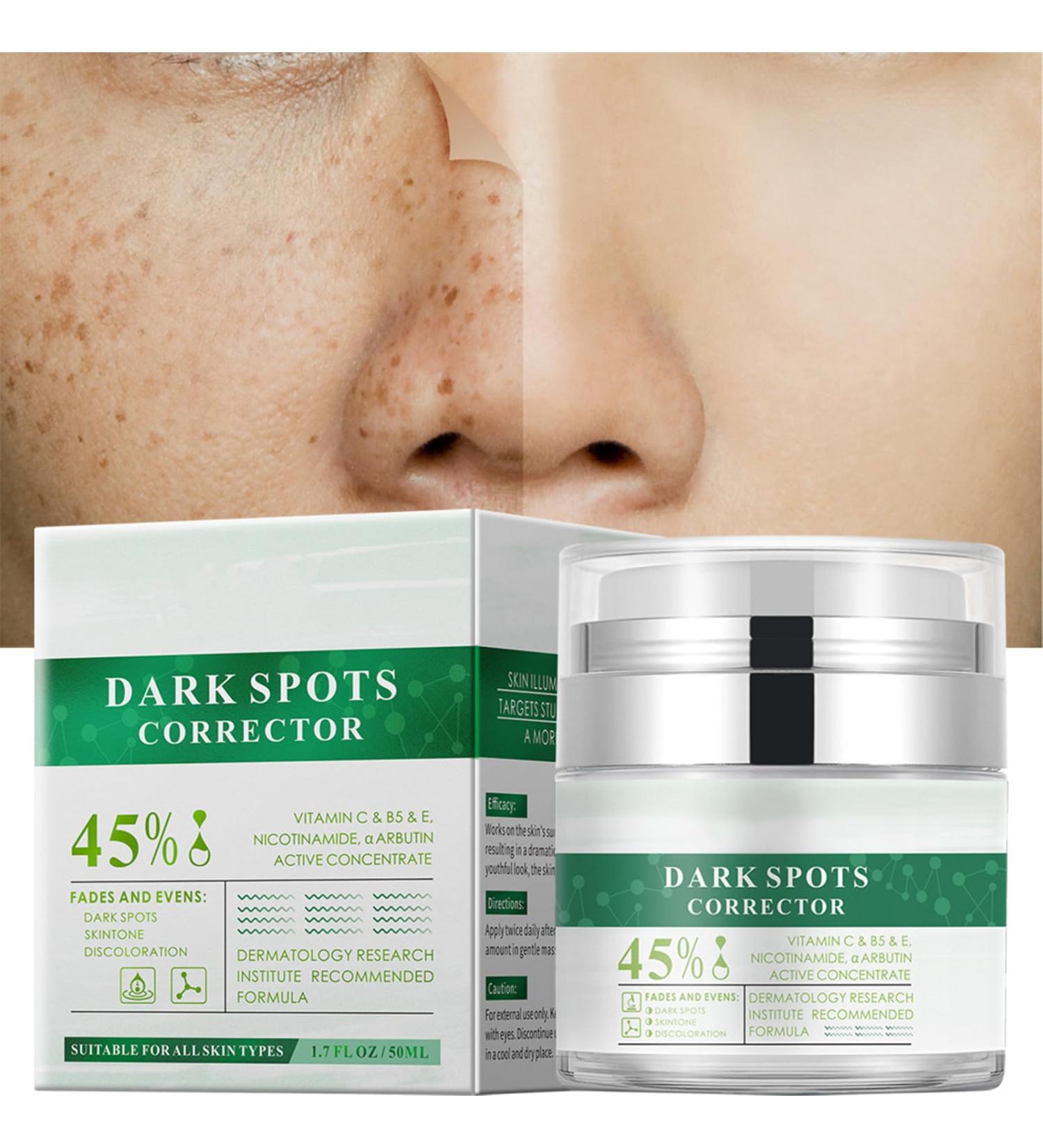 Go Ho Dark Spots Corrector - Vitamin C & B5 Skin Whitening Cream for Body & Intimate Areas Dark Spot Remover for Face - 1.7oz - Buy Online on GoSupps.com