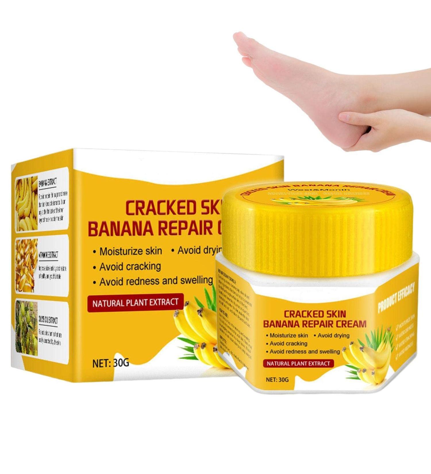  smashing smashing Chapped Feet Repair Cream | Banana Foot Repair Skin Healing Moisturizing 30g Chapped Heel Moisturizer Foot Repair for Removing Dead Skin - Buy Online on GoSupps.com