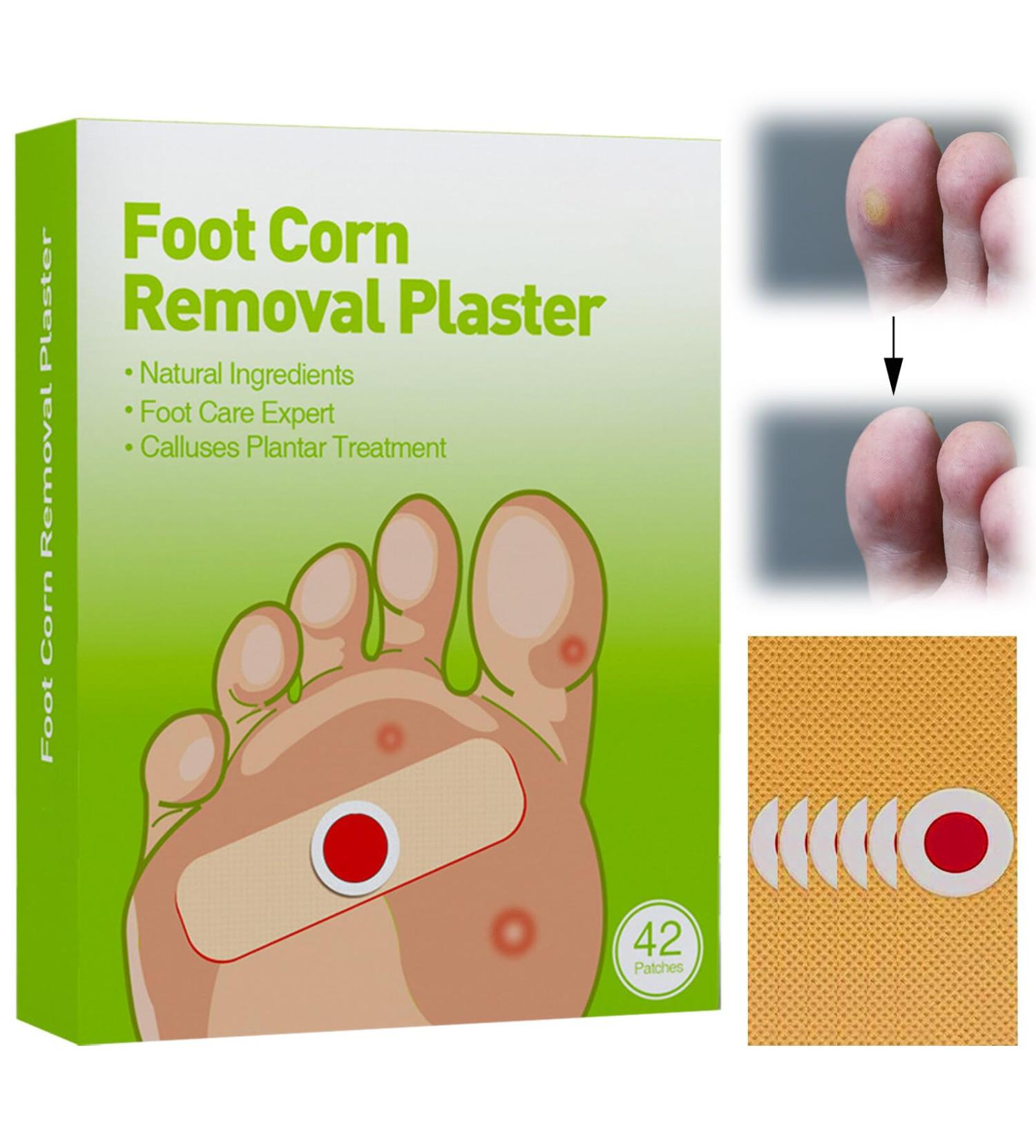 84 Corn Removal Pads - Effective Treatment for Chicken Eyes Foot Sole Corns and Warts - Buy Online on GoSupps.com