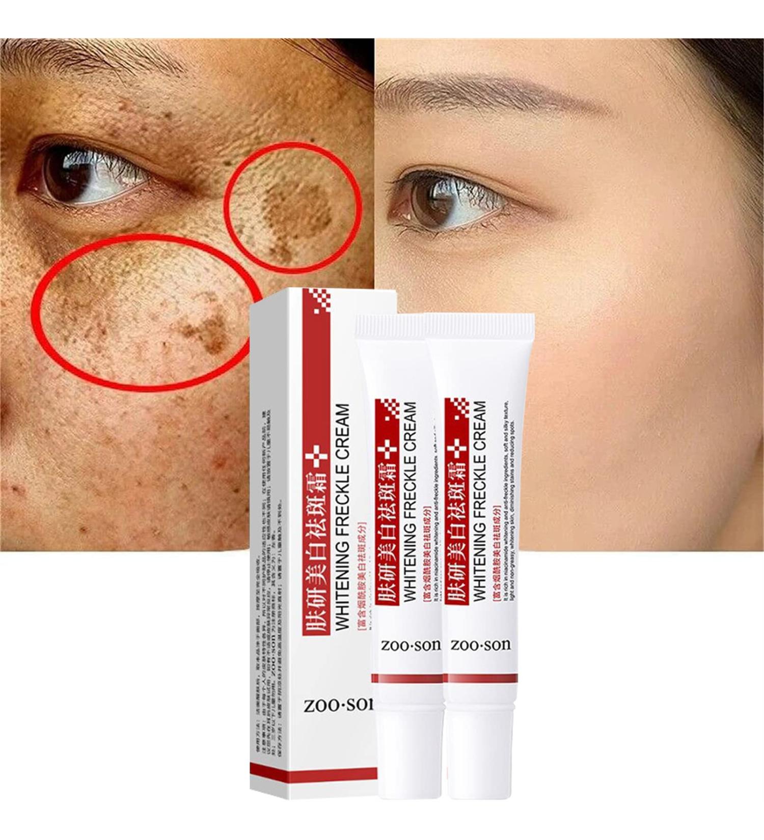 Spot Off Freckle Whitening & Dark Spot Corrector Cream - Acne Scar & Melasma Removal Treatment for Face (2 Pcs) - Buy Online on GoSupps.com