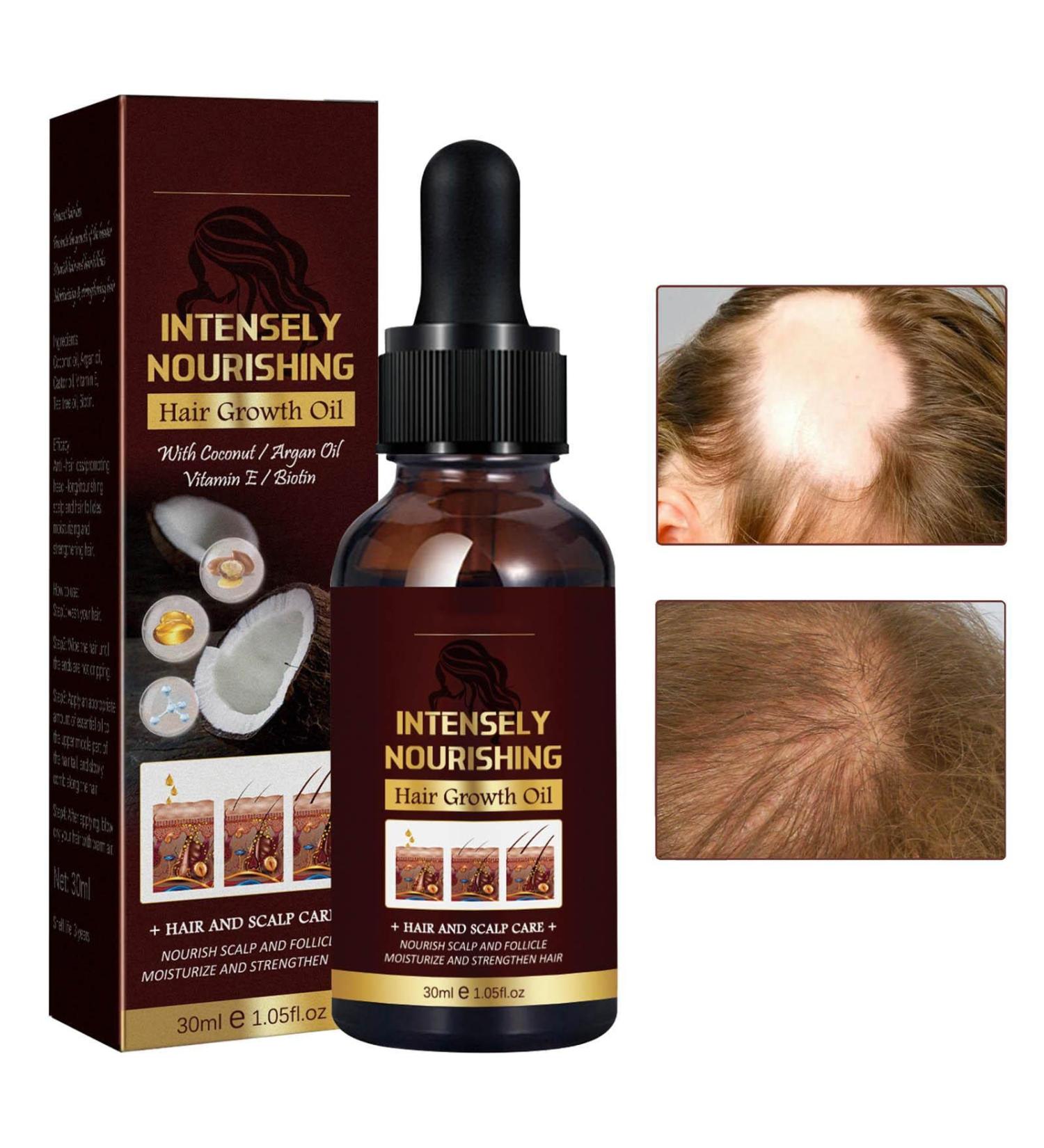  Niktule Hair Growth Essence 30ml Hair Conditioner promotes growth and reduces hair loss - Hair products with rich nutrition reduce hair loss and thinning hair - Buy Online on GoSupps.com