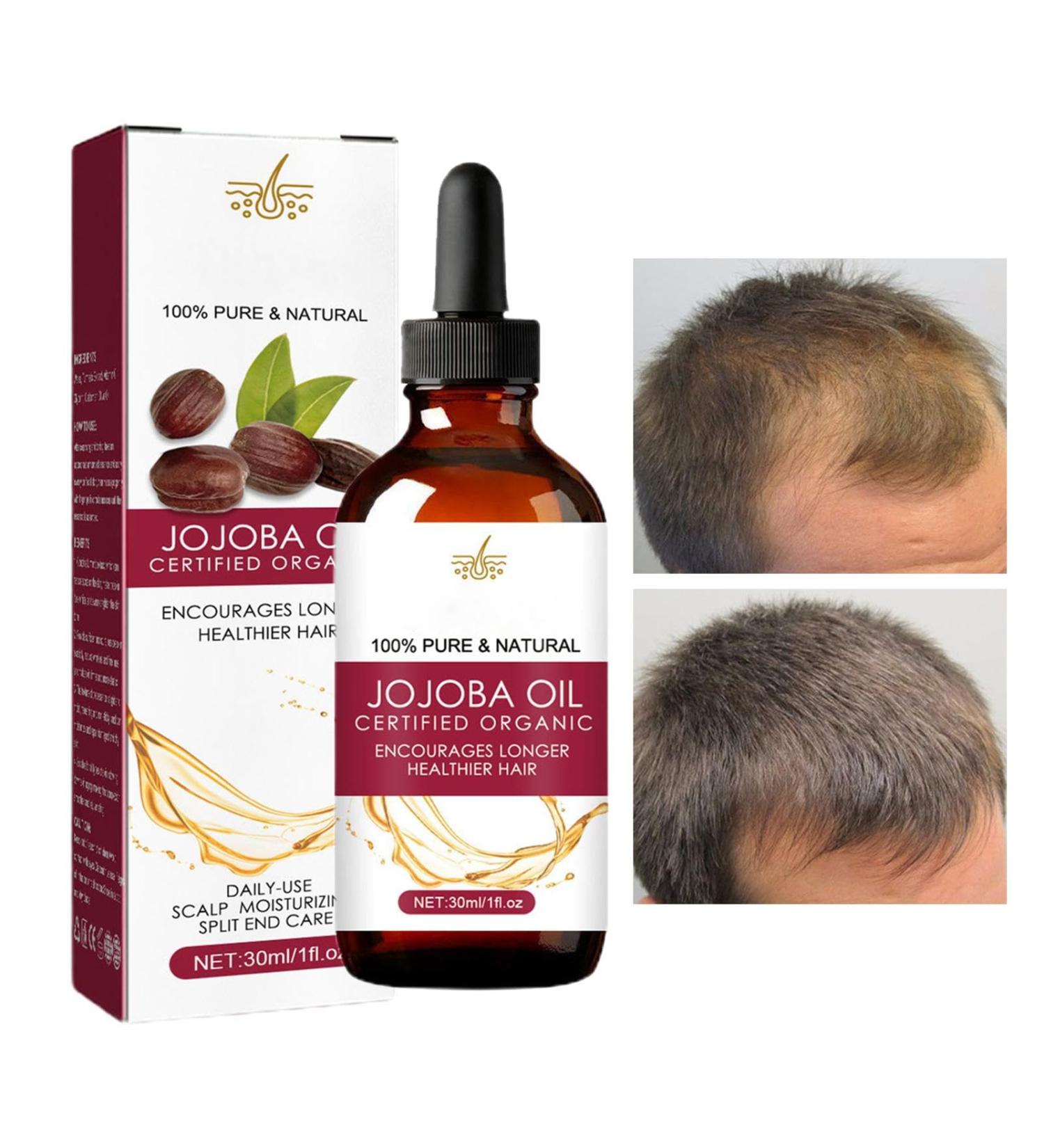  Whnbuij Hair Growth Oil - Natural Hair Oil For Women And Men Regrowth Oil For Thinning Hair | Nourishing Jojoba Oil Anti Frizz Hair Density Oil - Buy Online on GoSupps.com