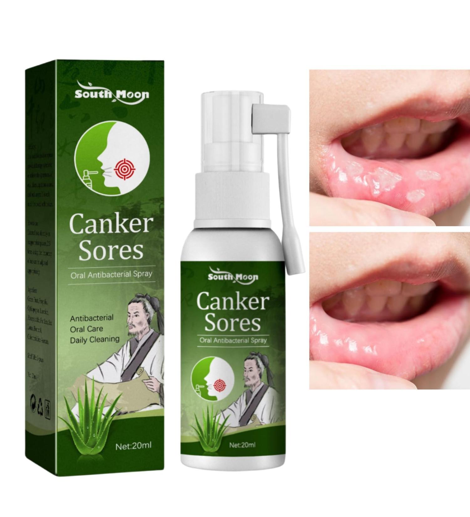 Mouth Ulcer Treatment Spray Mouth Ulcer Spray Mouth Ulcer Treatment for Adults Canker Sore Treatment Herbal Mouth Spray Breath Spray for Bad Breath Canker Relief Spray Mouth Freshener Spray 20ml - Buy Online on GoSupps.com